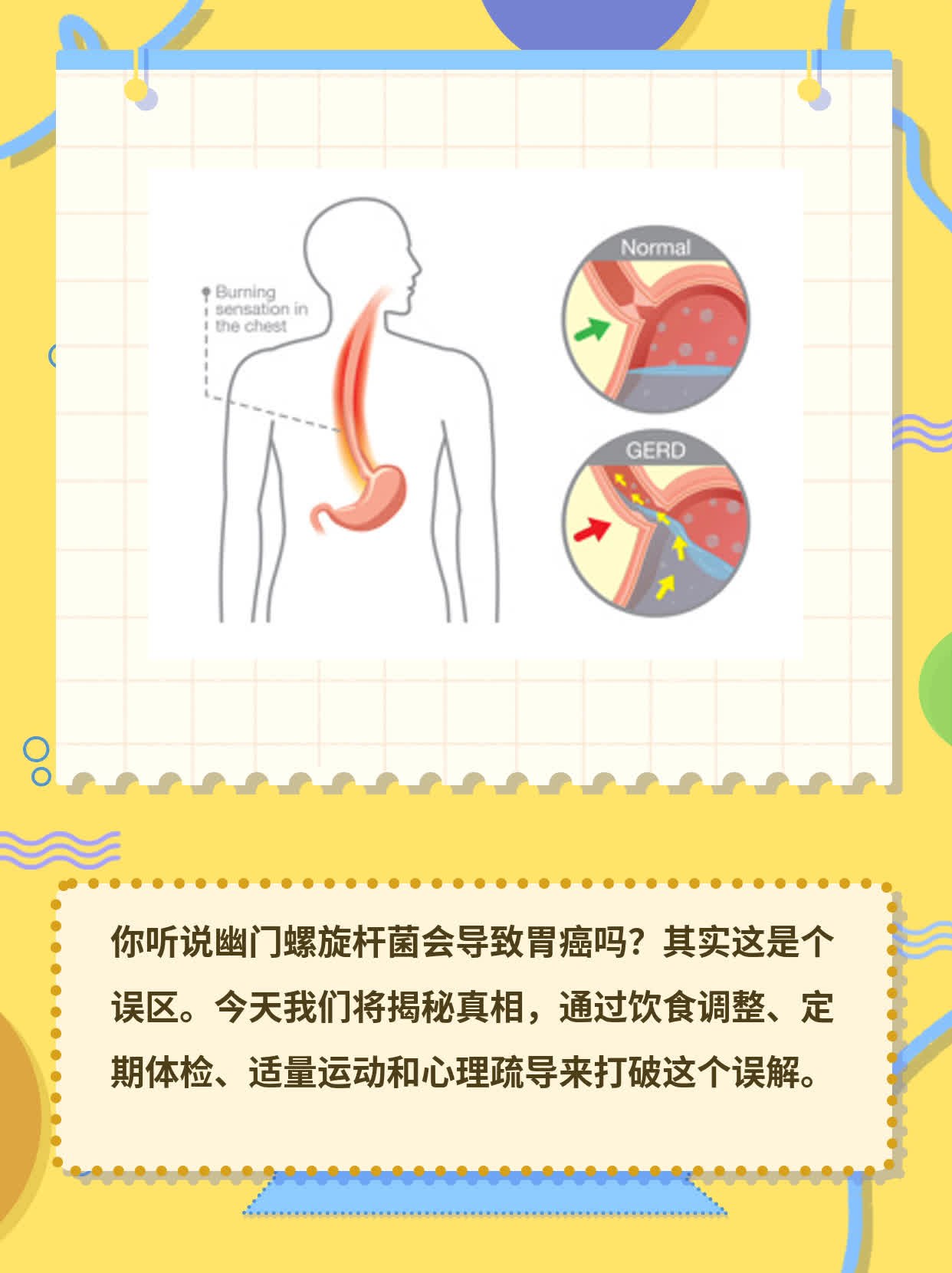 # 打破幽门螺旋杆菌=胃癌误解：真相大揭秘！
