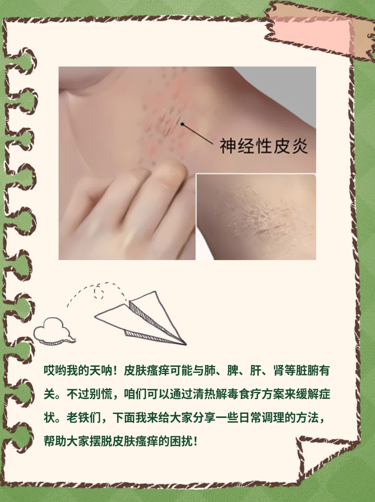 「揭秘」皮肤瘙痒找谁？探寻中医辨证答案！