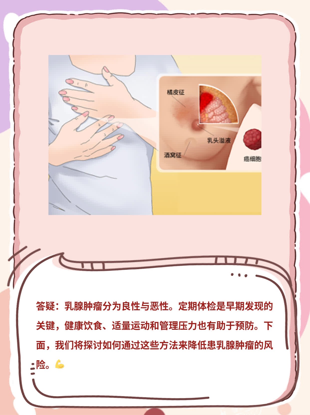 「答疑」乳腺肿瘤：良性or恶性？