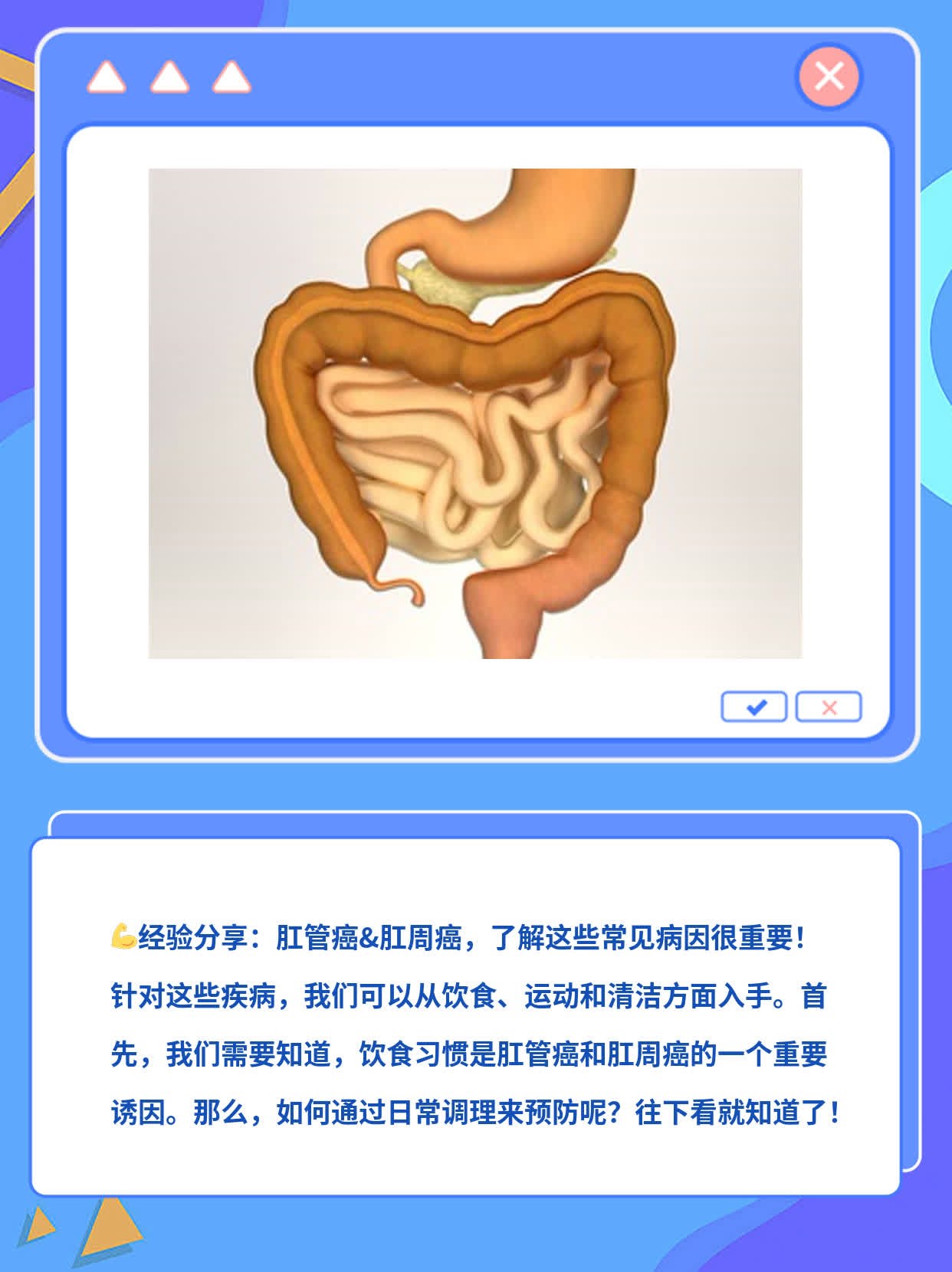 「经验分享」肛管癌&肛周癌：常见病因探秘