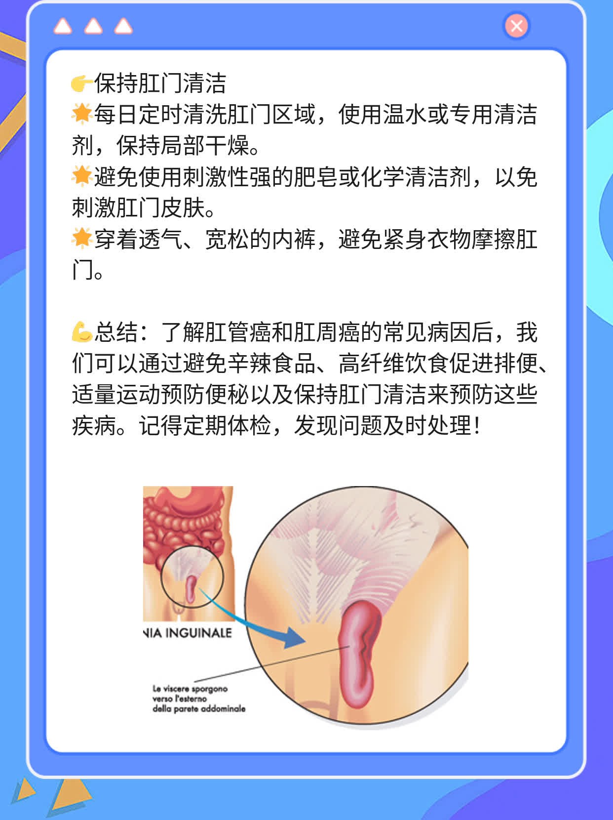 「经验分享」肛管癌&肛周癌：常见病因探秘