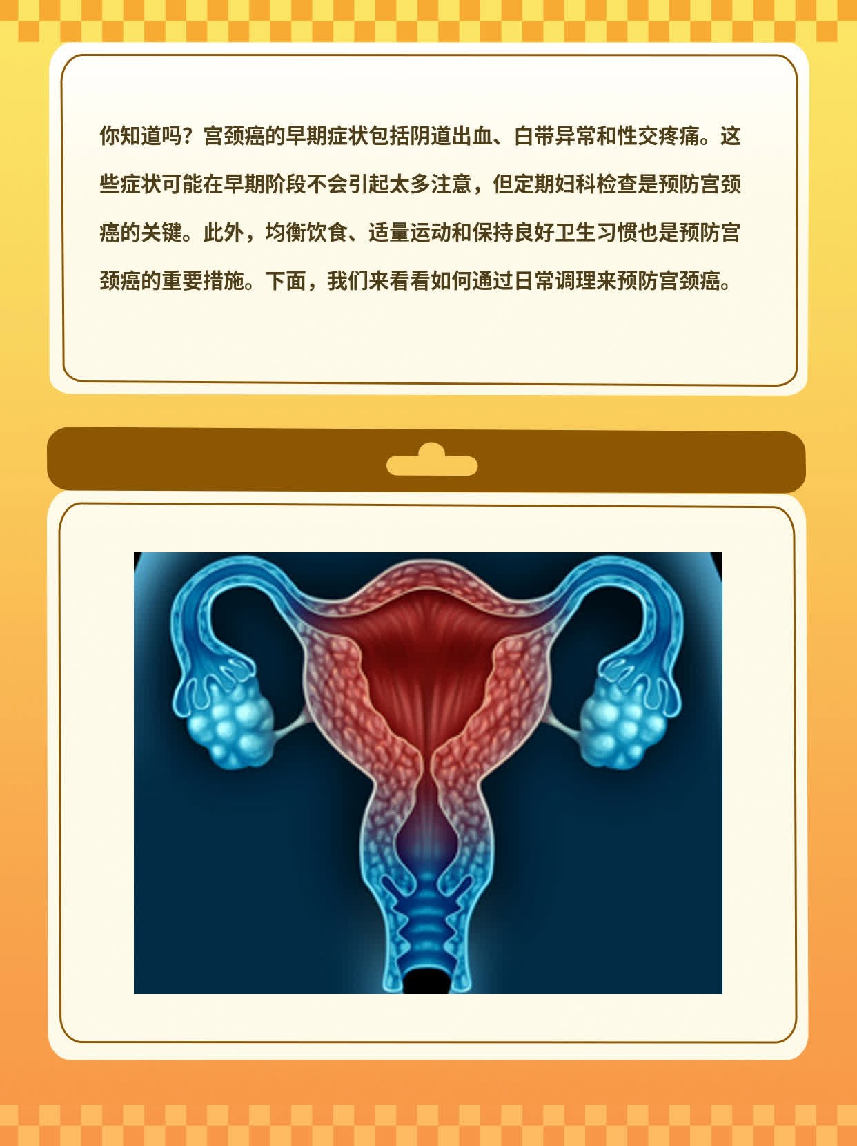 「宫颈癌早期症状」你知道吗？