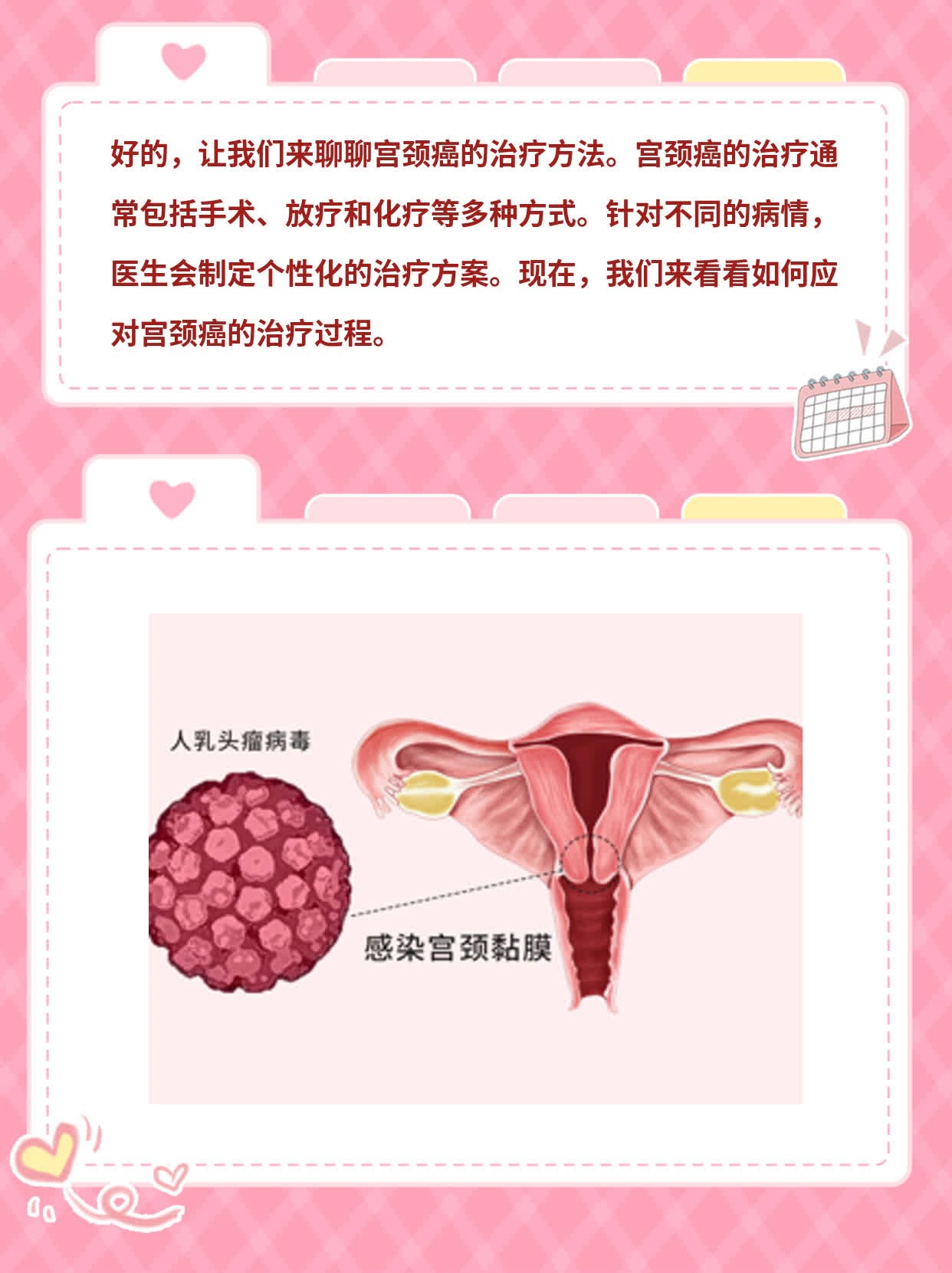「宫颈癌治疗」经验分享：探索主要疗法！