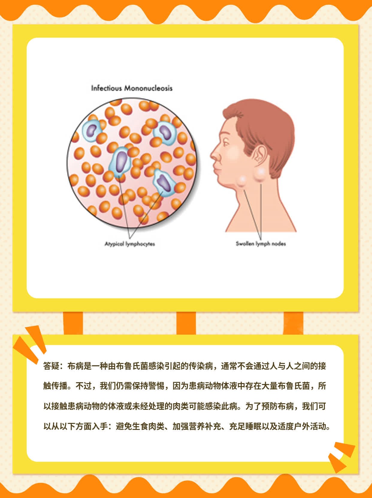 「答疑」布病：它是什么病？人与人之间会传染吗？