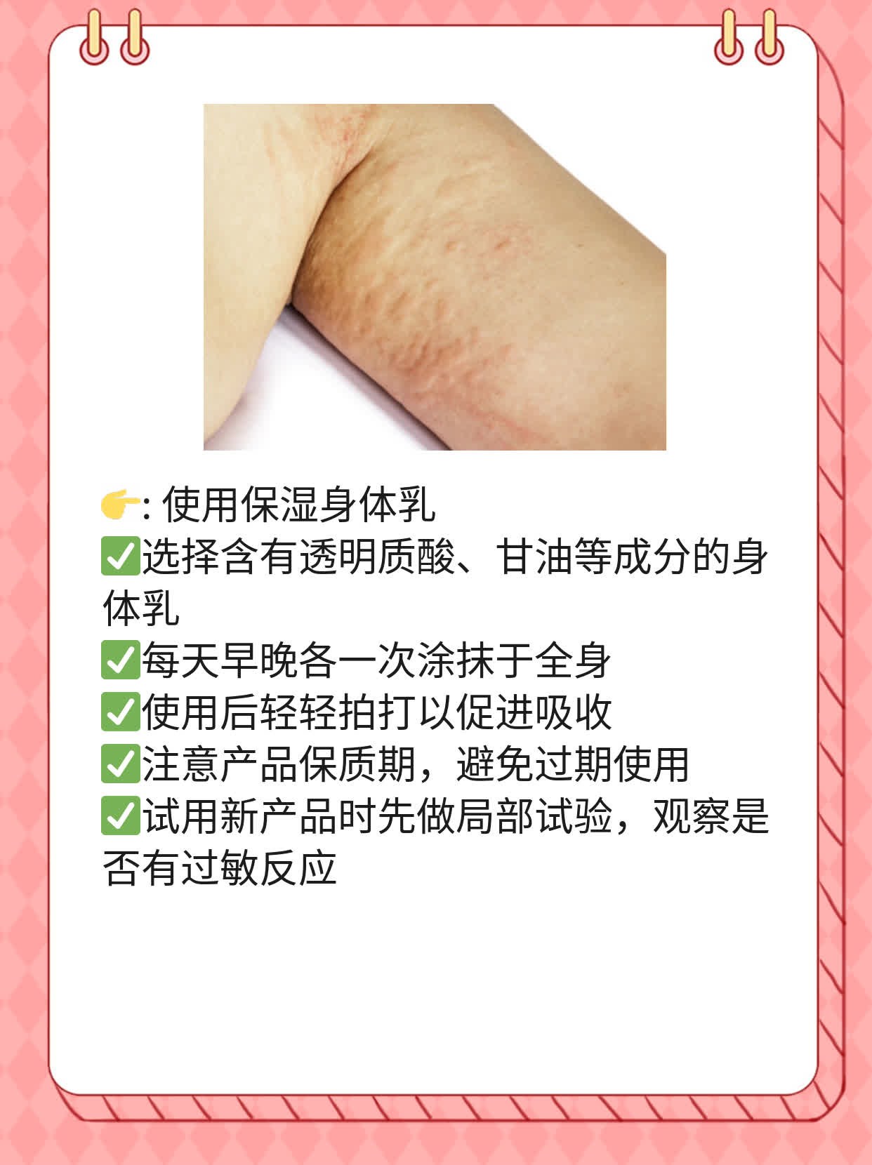 洗澡后皮肤瘙痒？试试这些方法！
