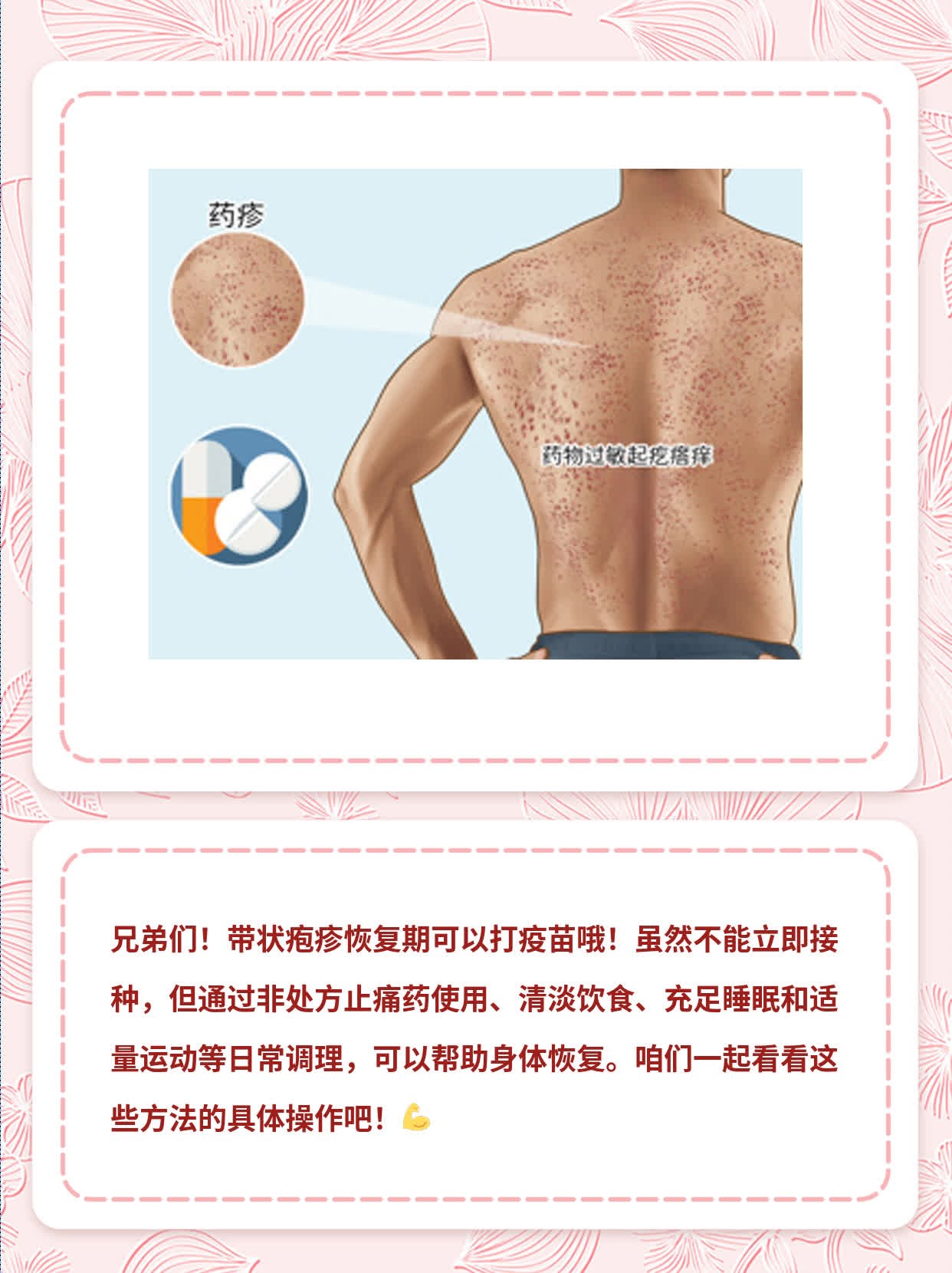 「带状疱疹恢复期可否接种疫苗」你知道吗？