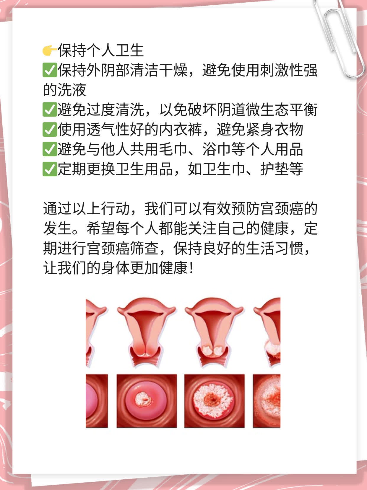 「宫颈癌筛查」——你不可不知的真相！