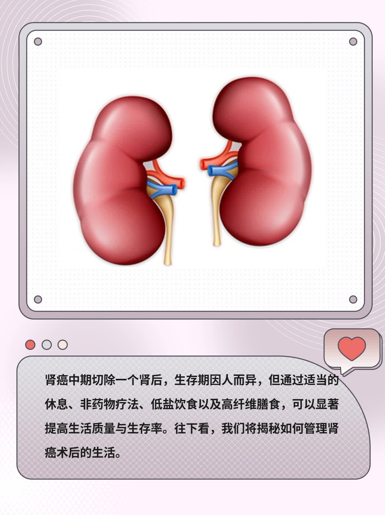 肾癌中期切肾后生存期：揭秘！