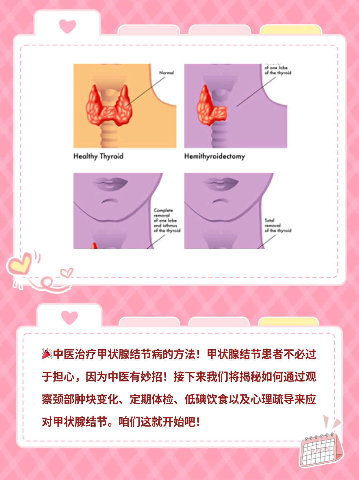 「揭秘」中医疗法解决甲状腺结节难题！