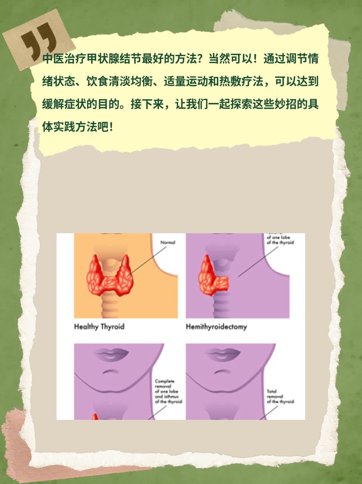 「揭秘」中医疗法根治甲状腺结节的妙招！