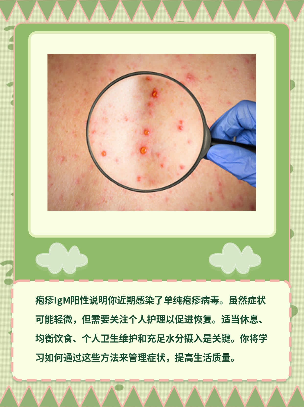 「疱疹IgM阳性」：揭秘单纯疱疹病毒感染的临床意义！