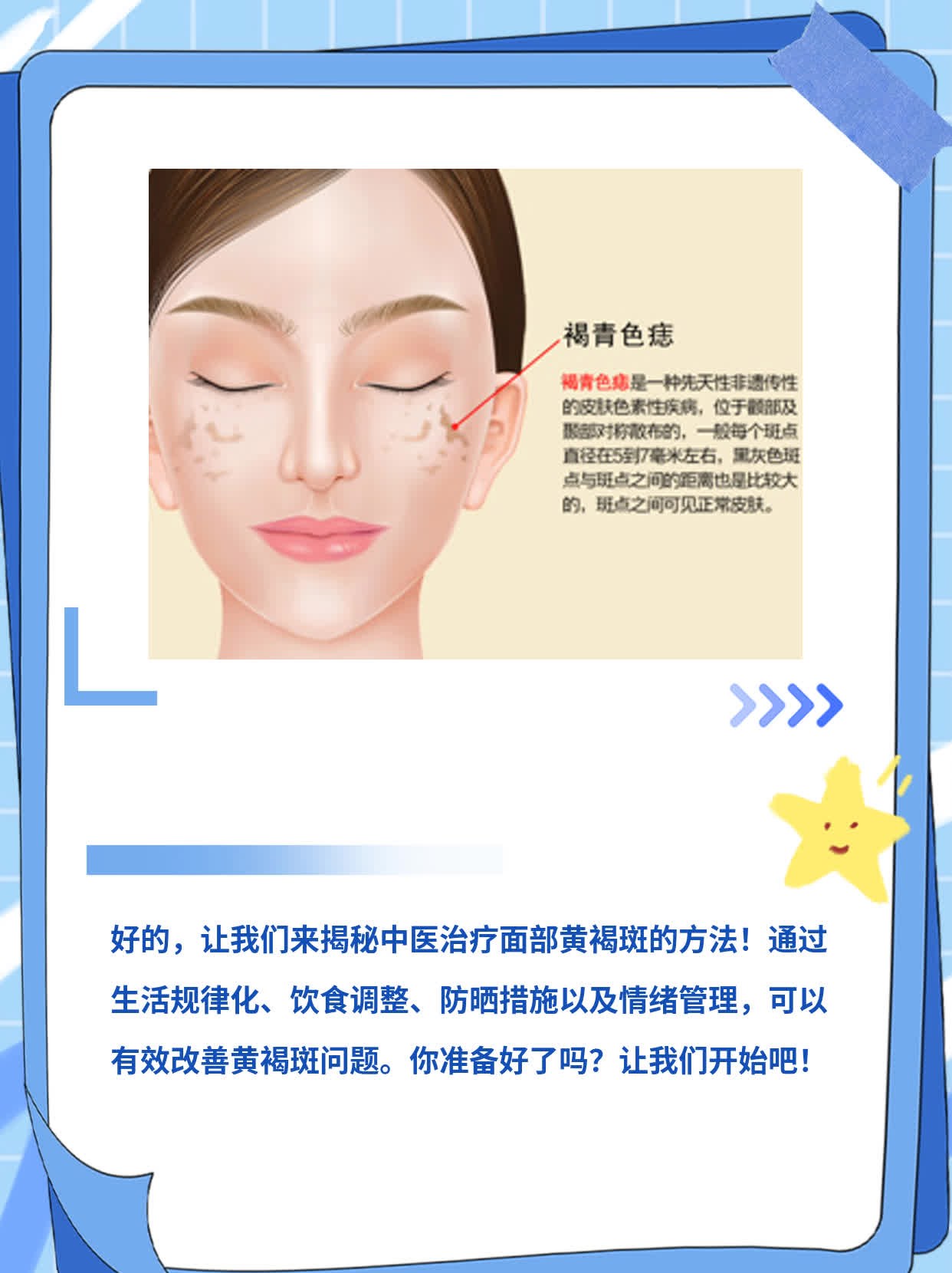 「揭秘」中医治面部黄褐斑的方法