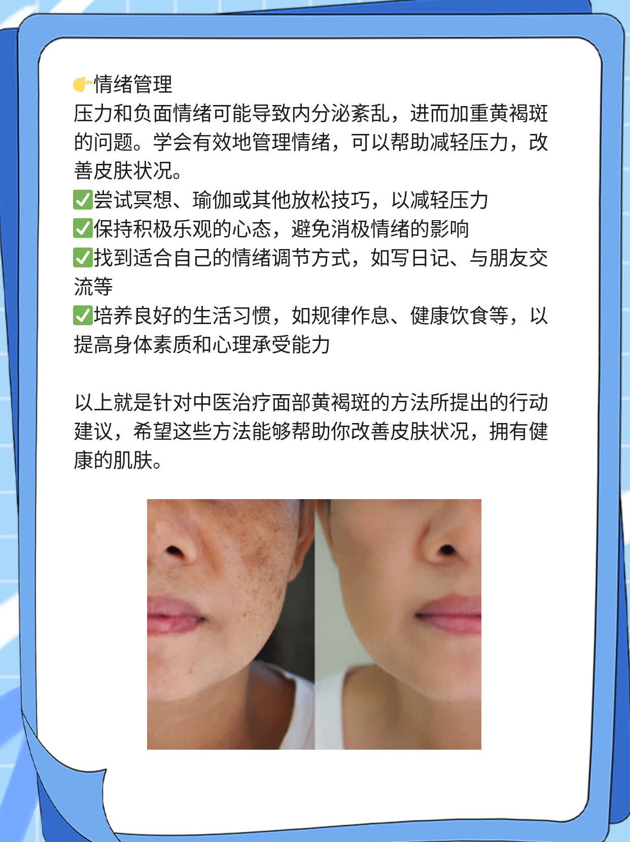 「揭秘」中医治面部黄褐斑的方法