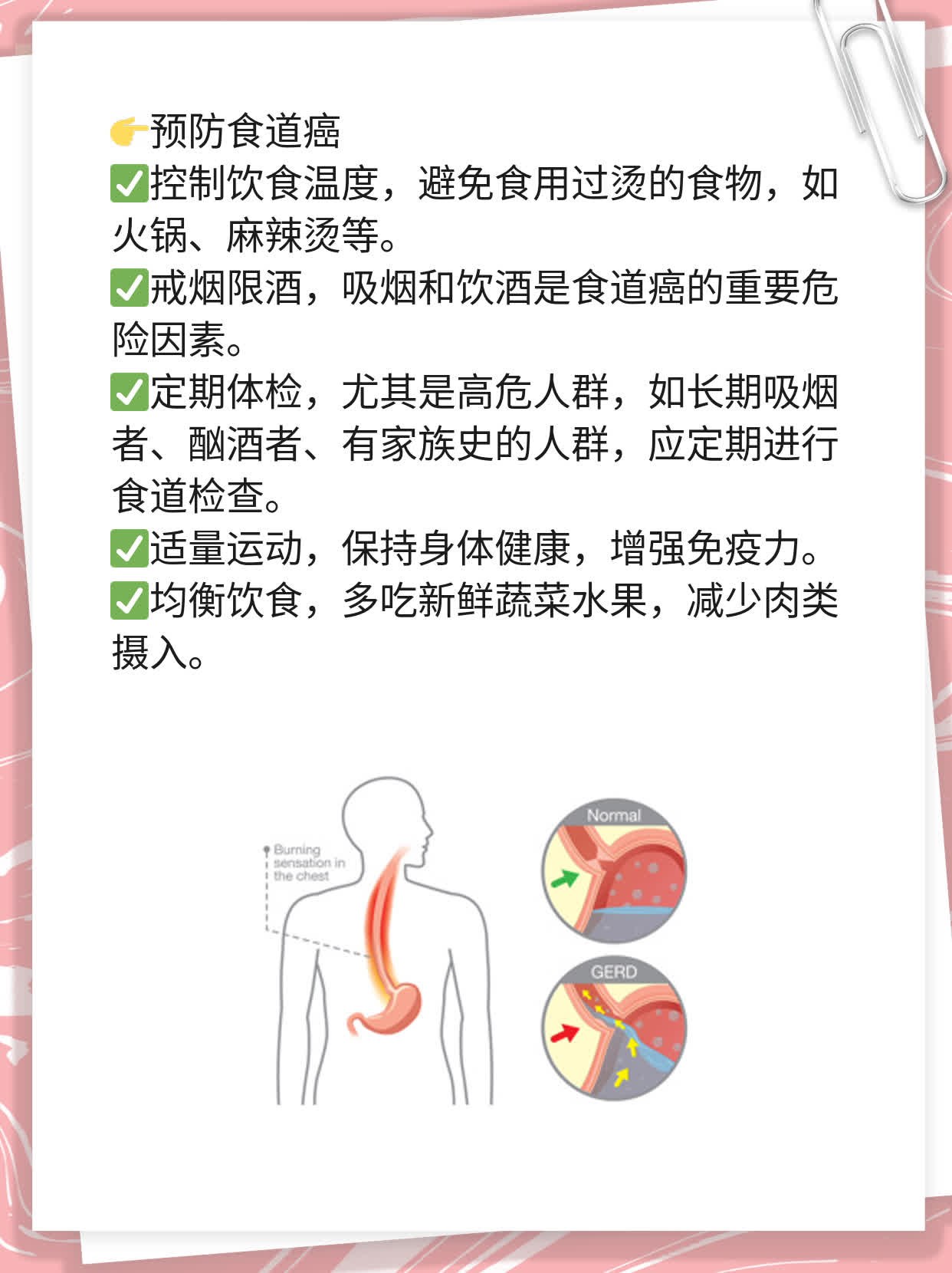「揭秘」食道癌诱因及症状解析