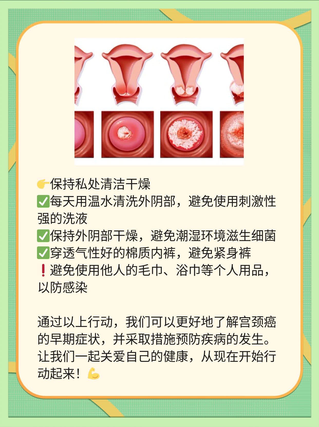 「宫颈癌早期症状」你知道吗？这些信号不容忽视！