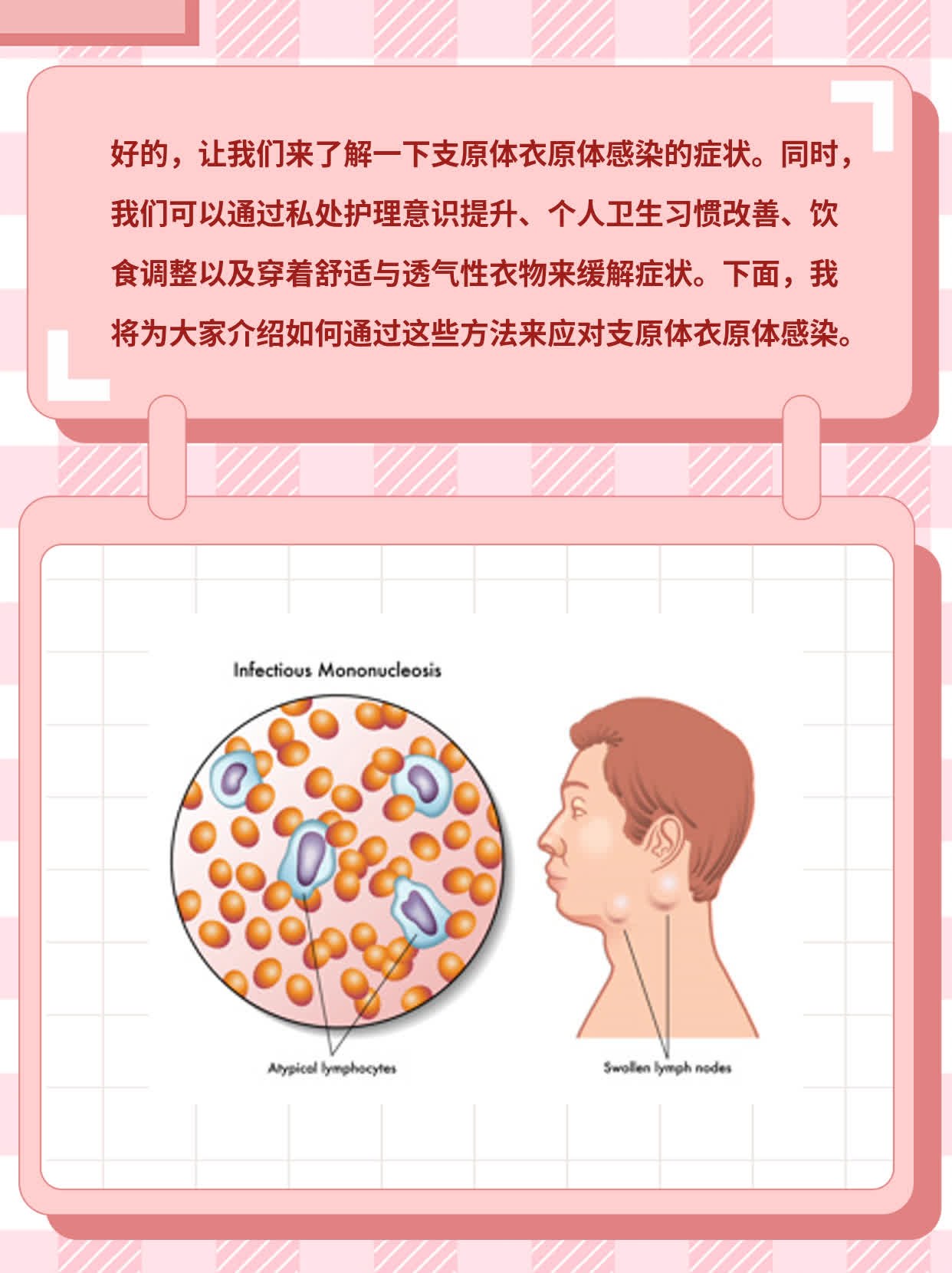 解密支原体衣原体感染：症状探秘