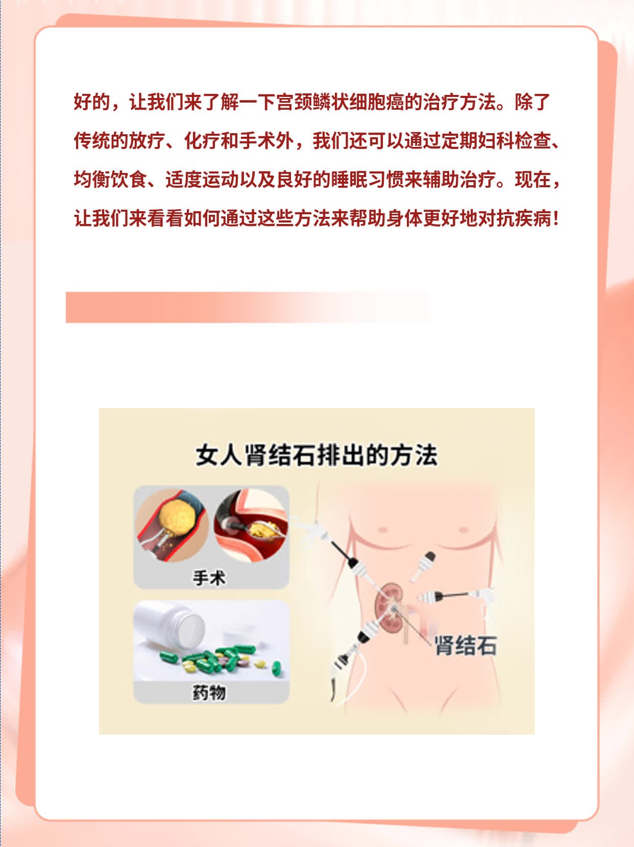 「宫颈鳞癌」治疗妙招大公开！