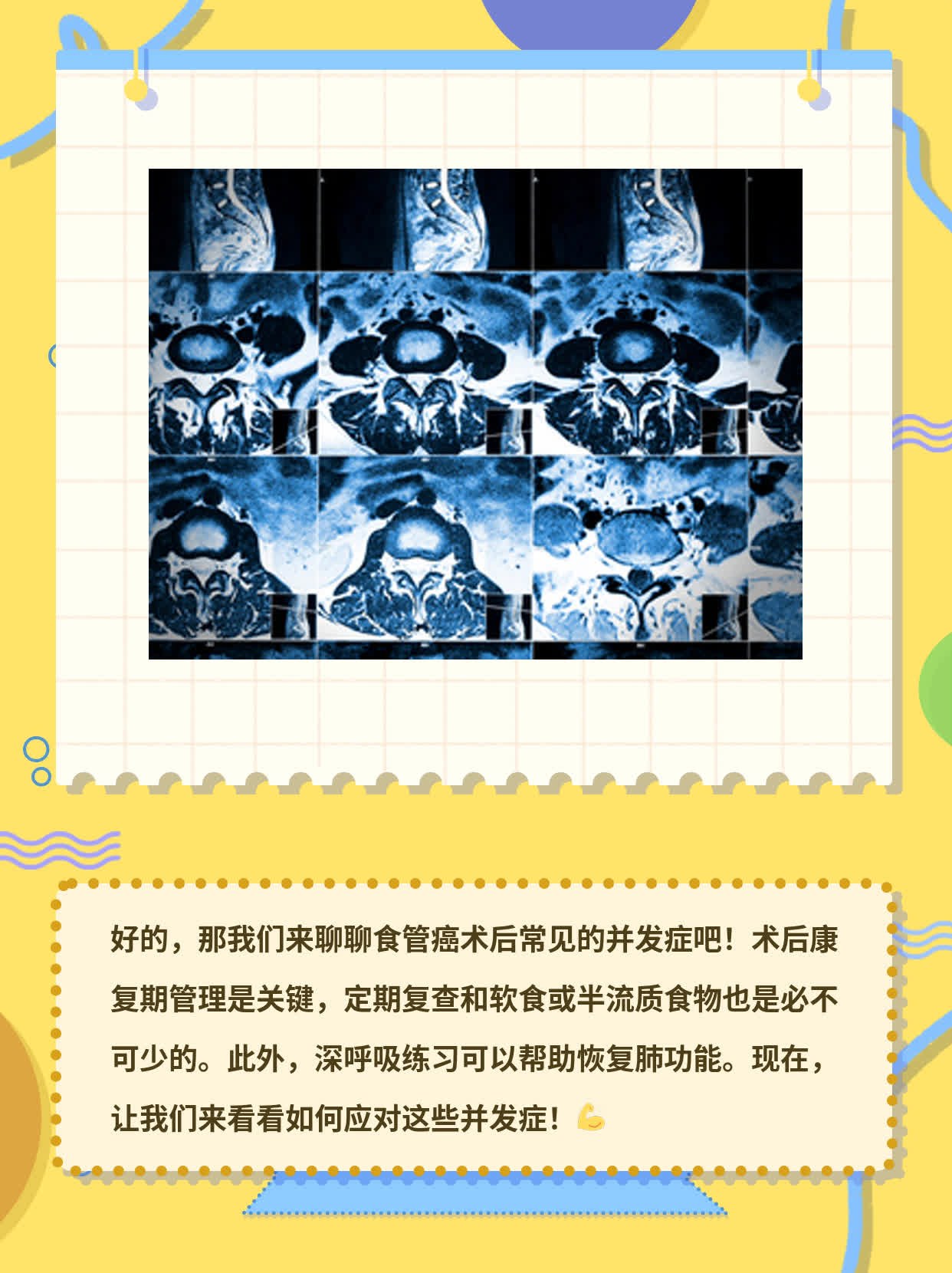 【经验分享】食管癌术后常见并发症大盘点！