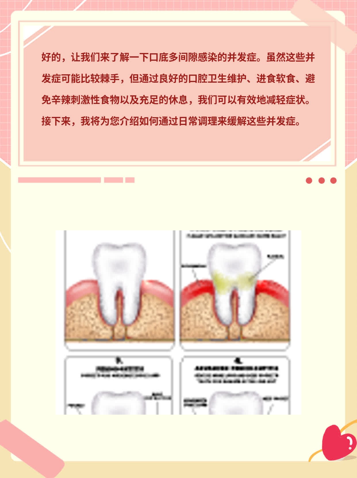 「口底多间隙感染」并发症大揭秘！