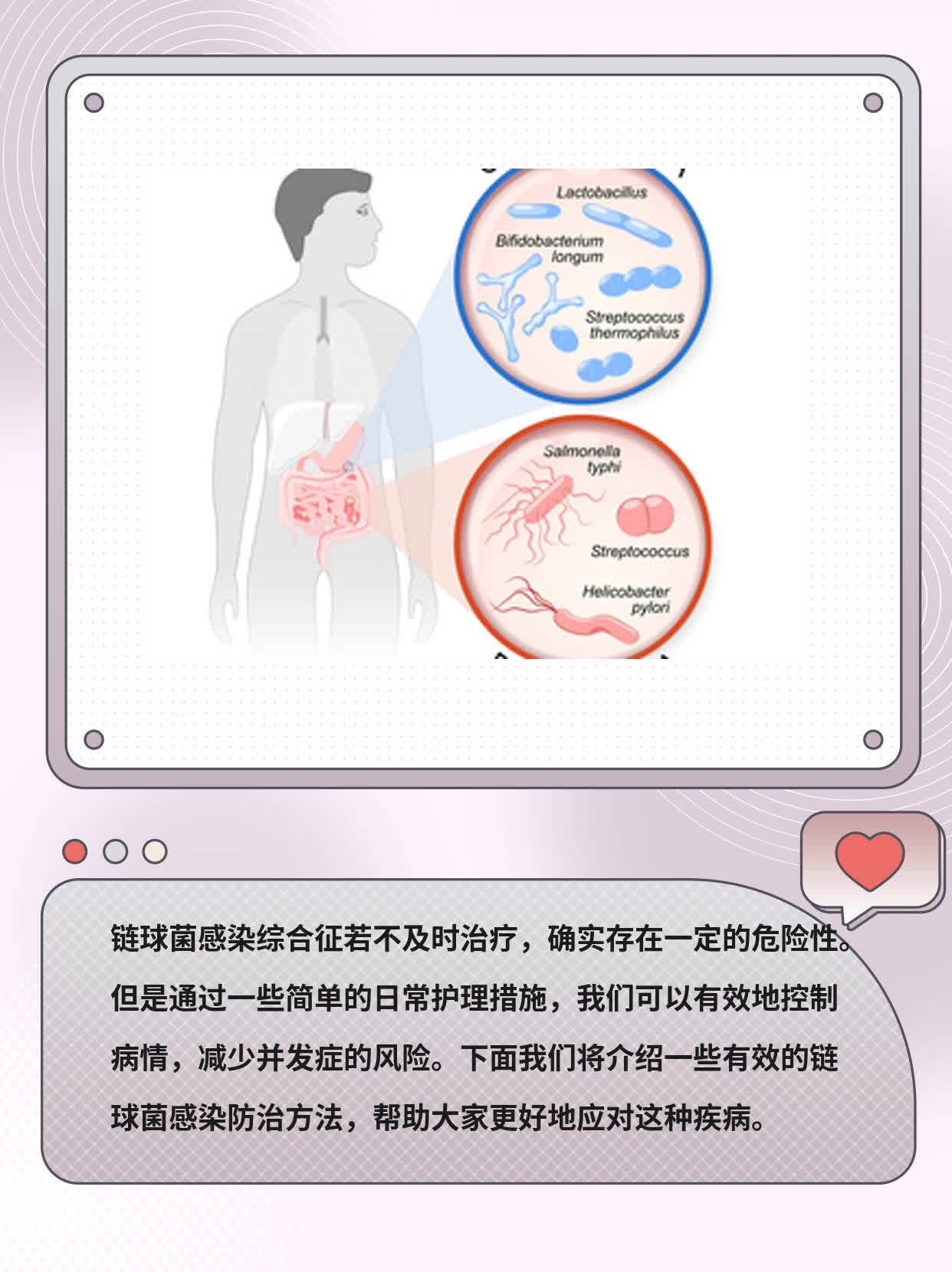 「链球菌感染」不治有危险吗？