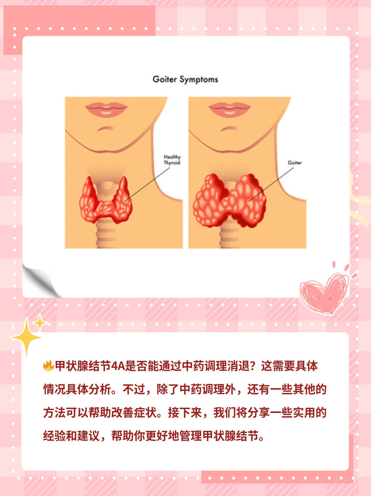 中药调理对甲状腺结节4A有作用吗？经验分享