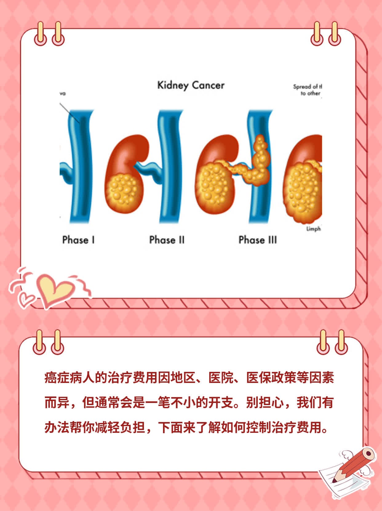 【经验分享】癌症病人治疗费用大揭秘！