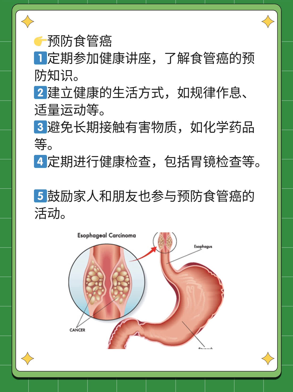「揭秘」食管癌为啥总拖到中晚期？