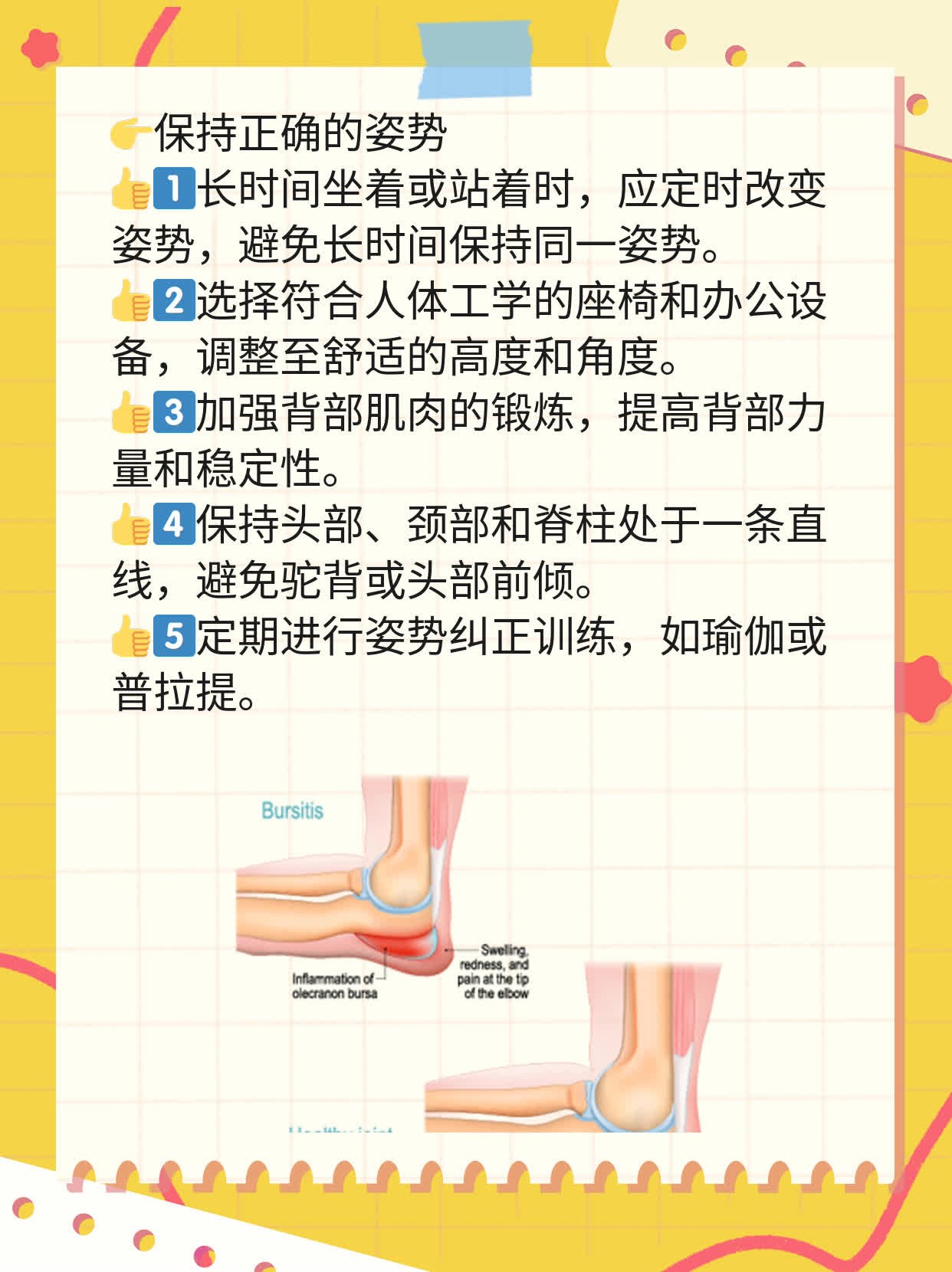 「经验分享」脊髓肿瘤的症状及临床表现探秘