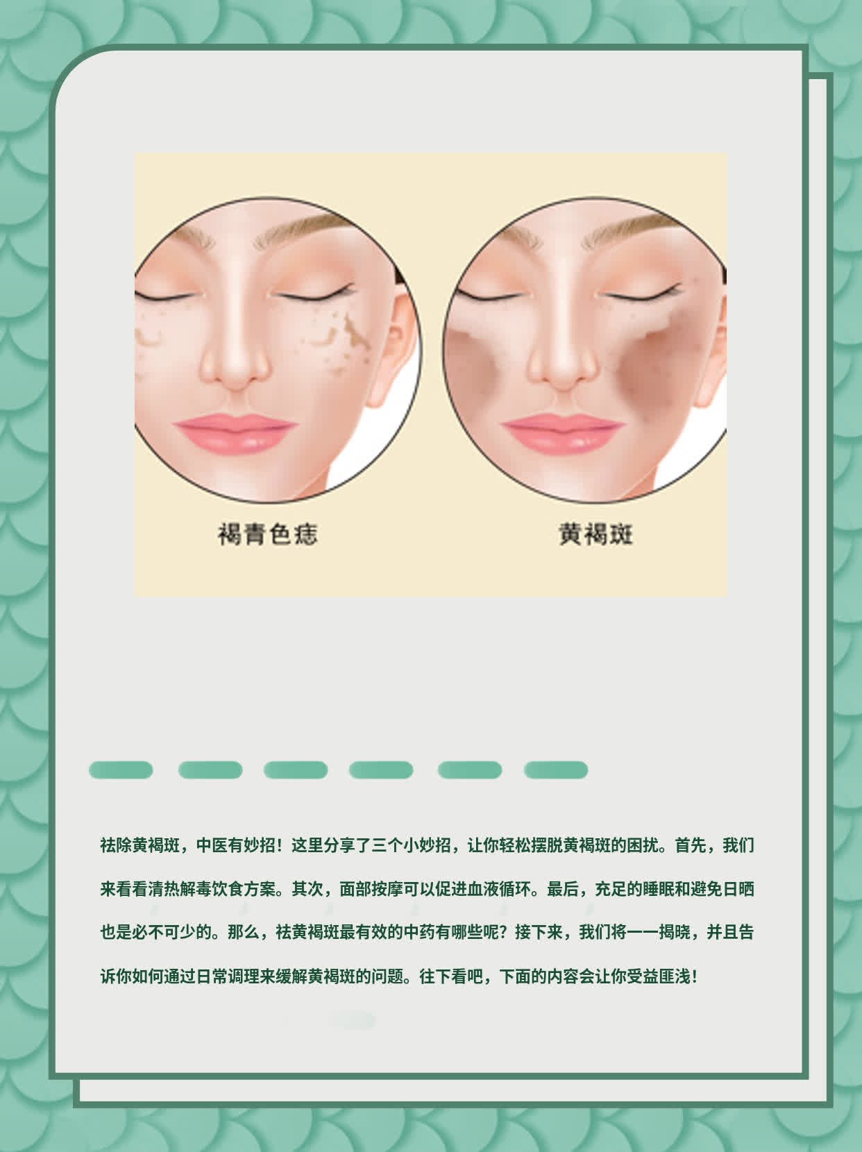 「排黄秘籍」：中药祛除黄褐斑的妙方