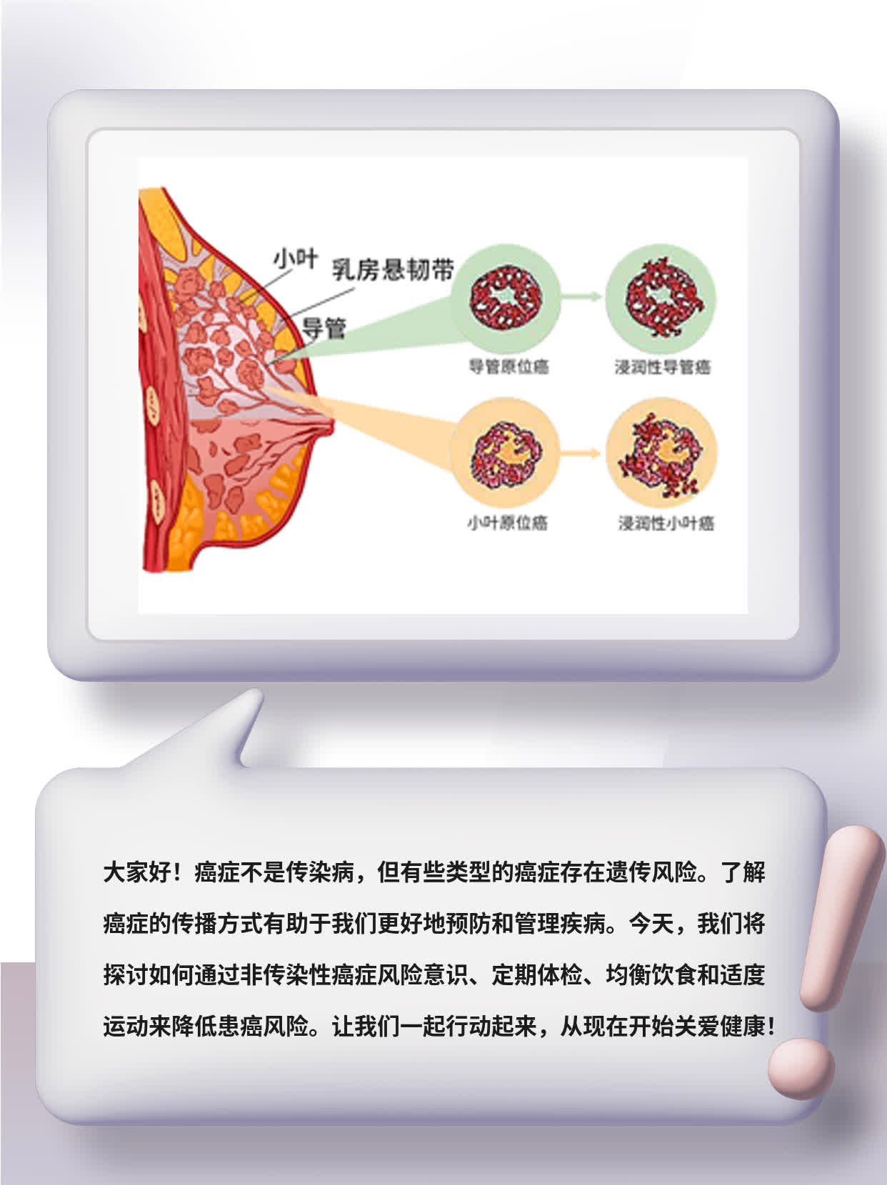 「癌症是否传染？传播方式揭秘」