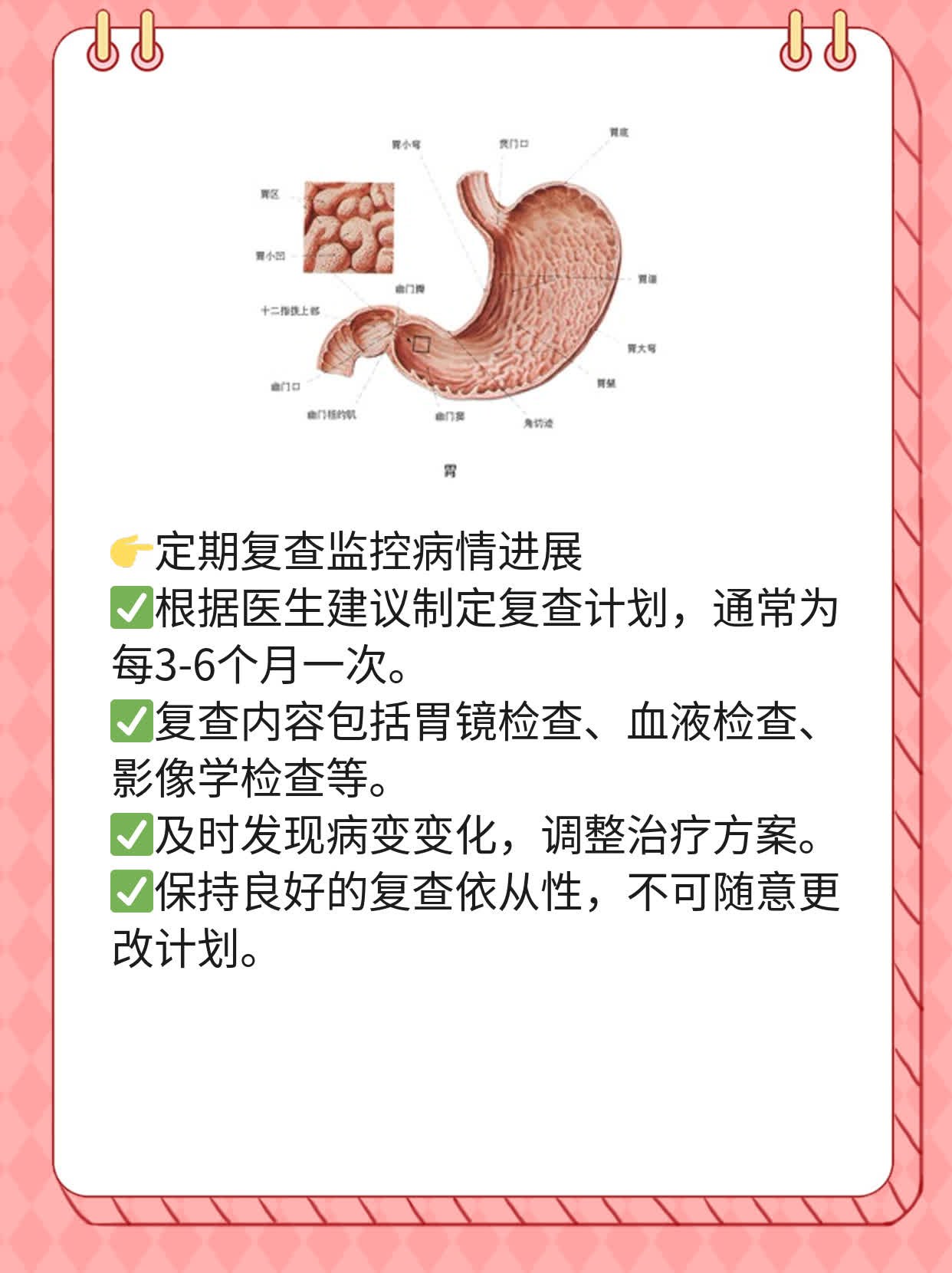 「答疑」揭秘：胃癌Lauren分型全解析