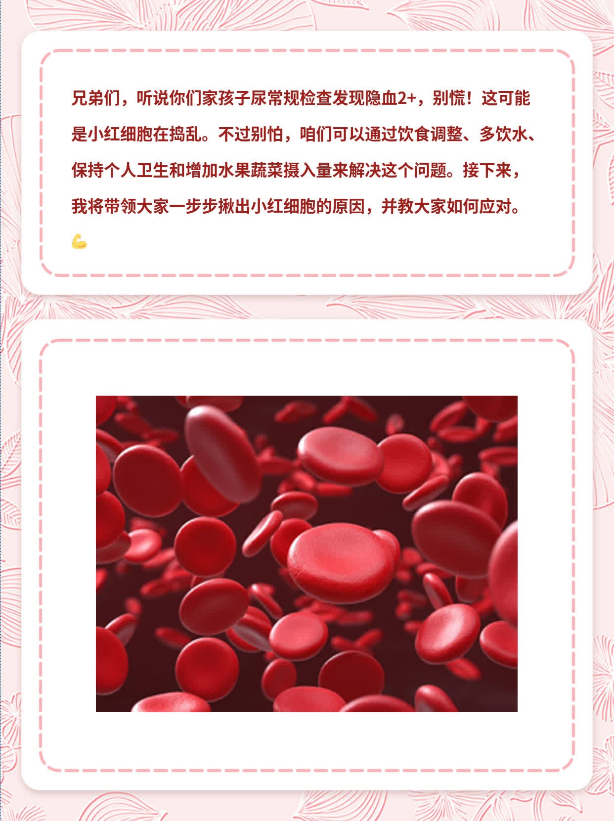 儿童尿隐血2+：揪出小红细胞的原因！