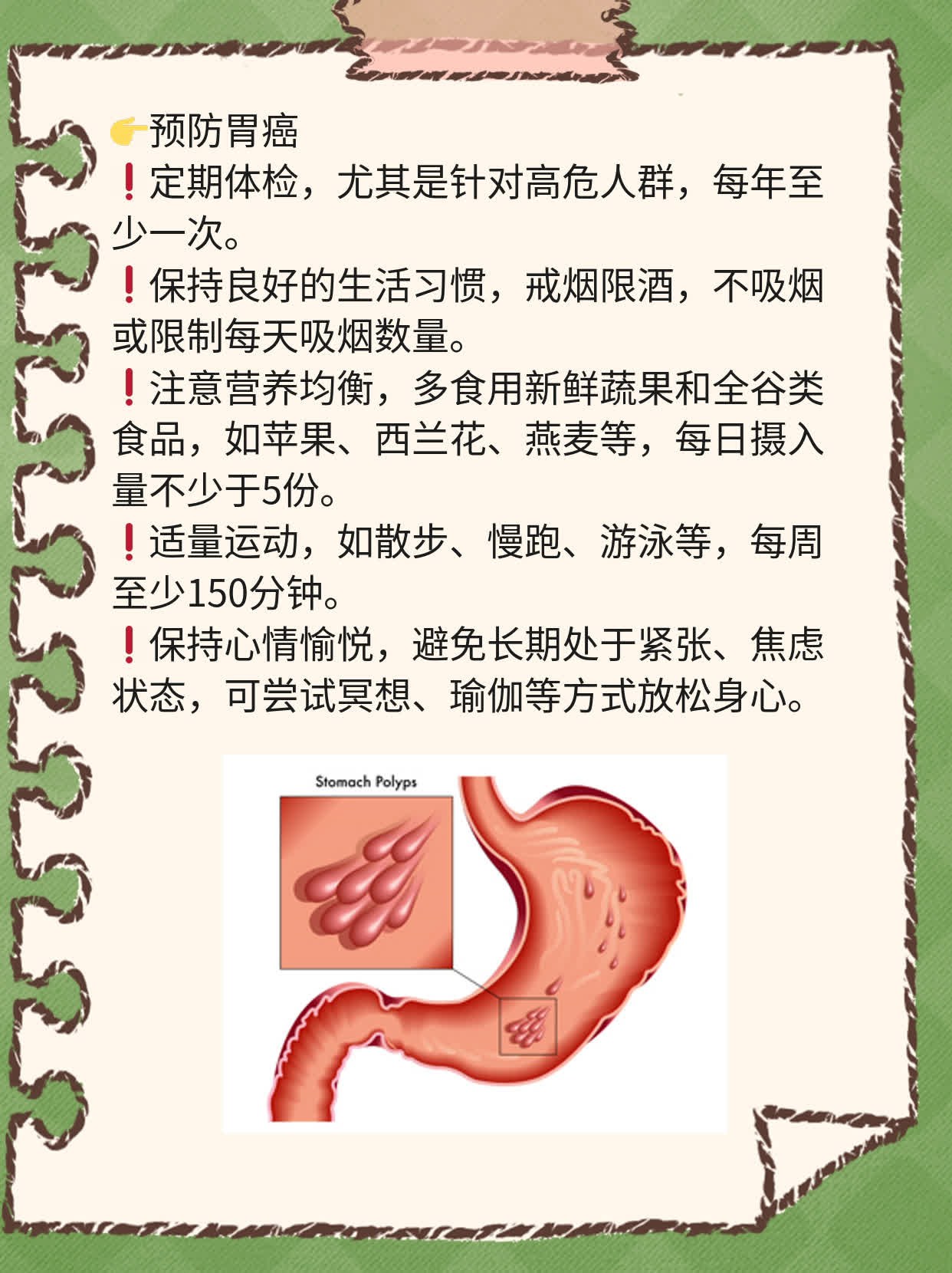 「经验分享」揭秘：胃癌常见转移途径