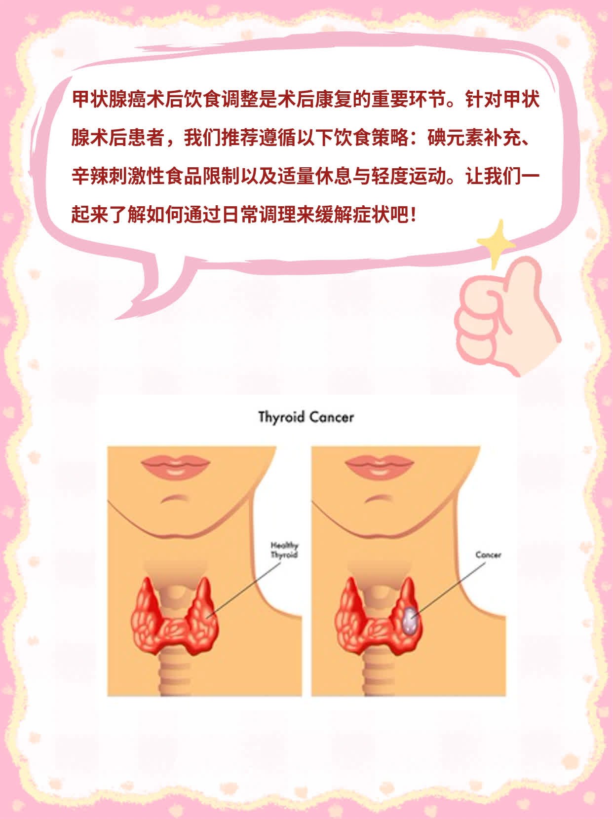 揭秘：甲状腺术后饮食攻略