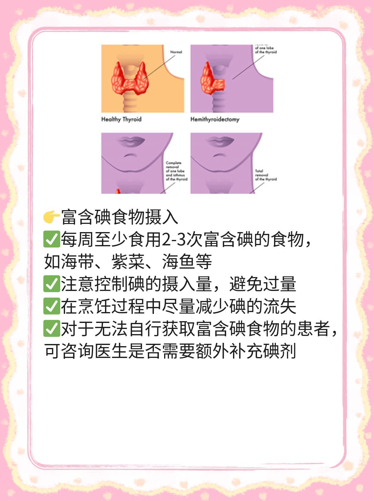 揭秘：甲状腺术后饮食攻略