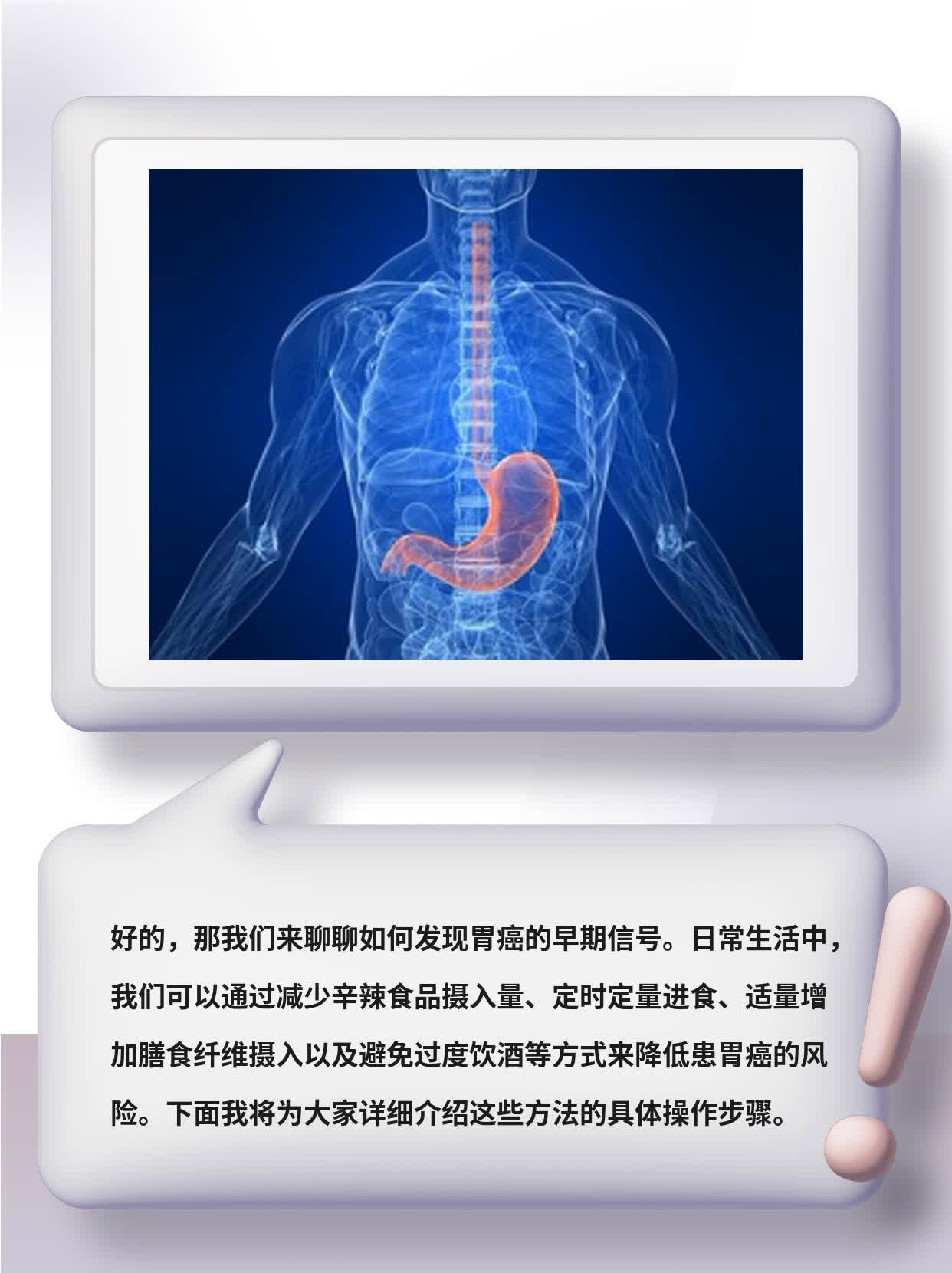 「经验分享」发现胃癌早期信号