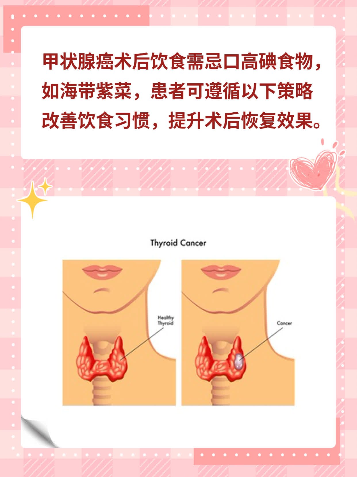 【实用】甲状腺癌术后饮食攻略：忌口大全！