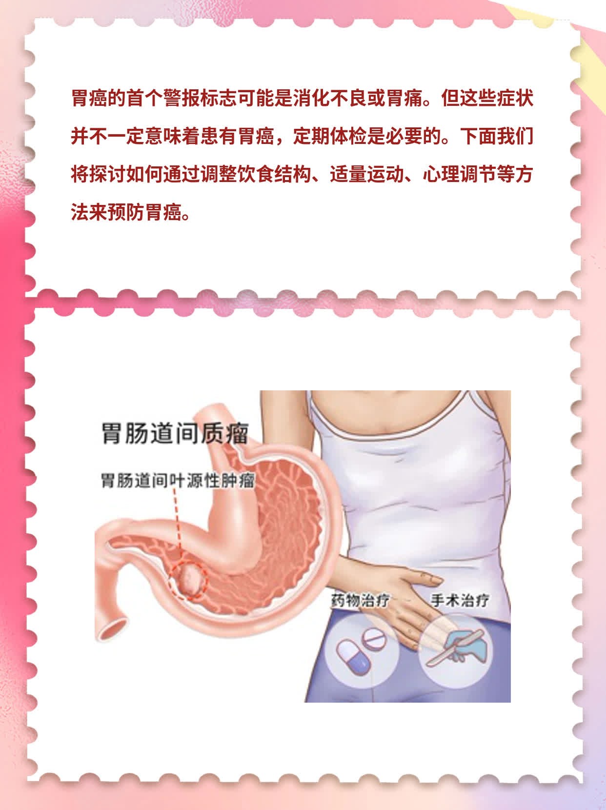 破解胃癌信号：首个警报标志探秘！