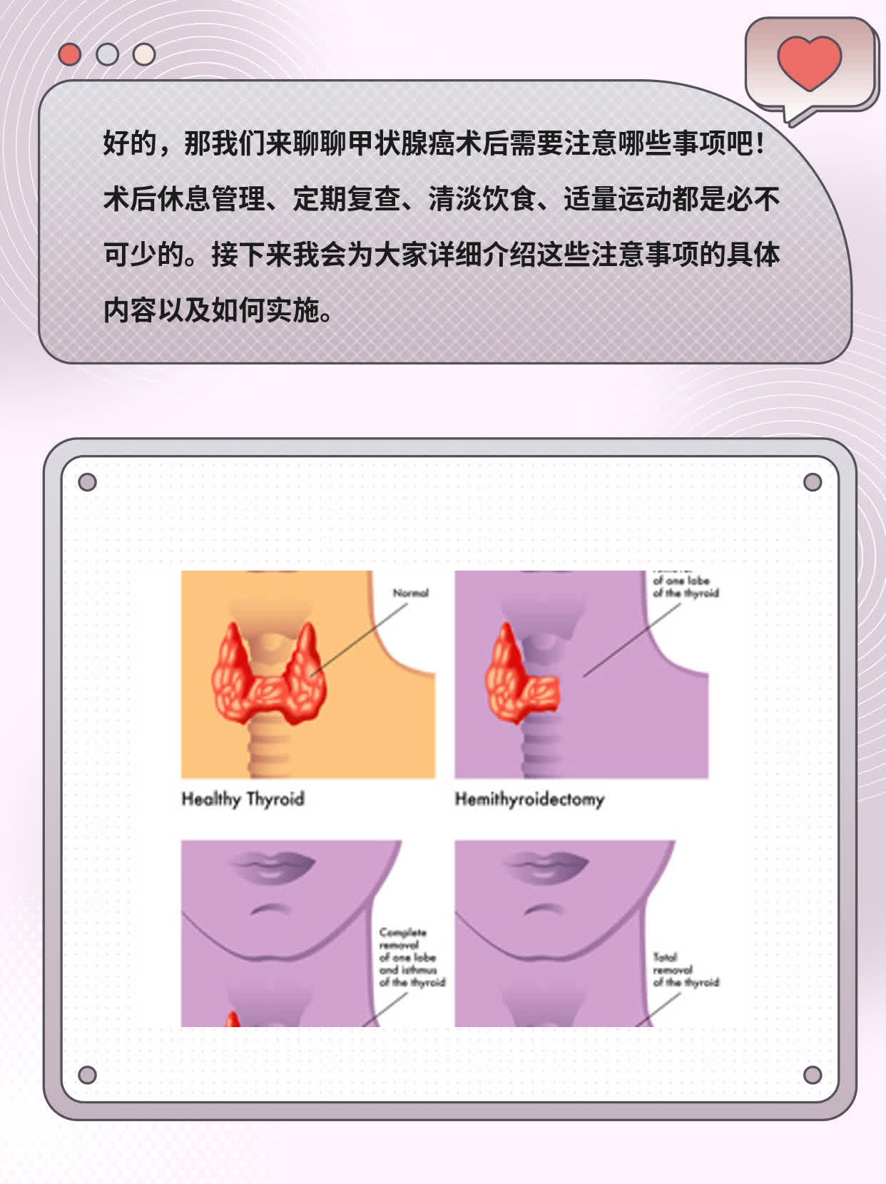【经验分享】甲状腺癌术后必备注意事项