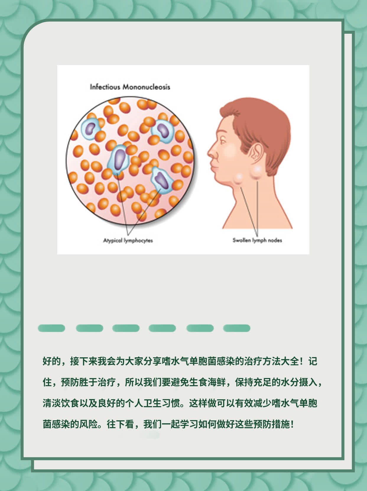 「分享」嗜水气单胞菌感染治疗法大全！