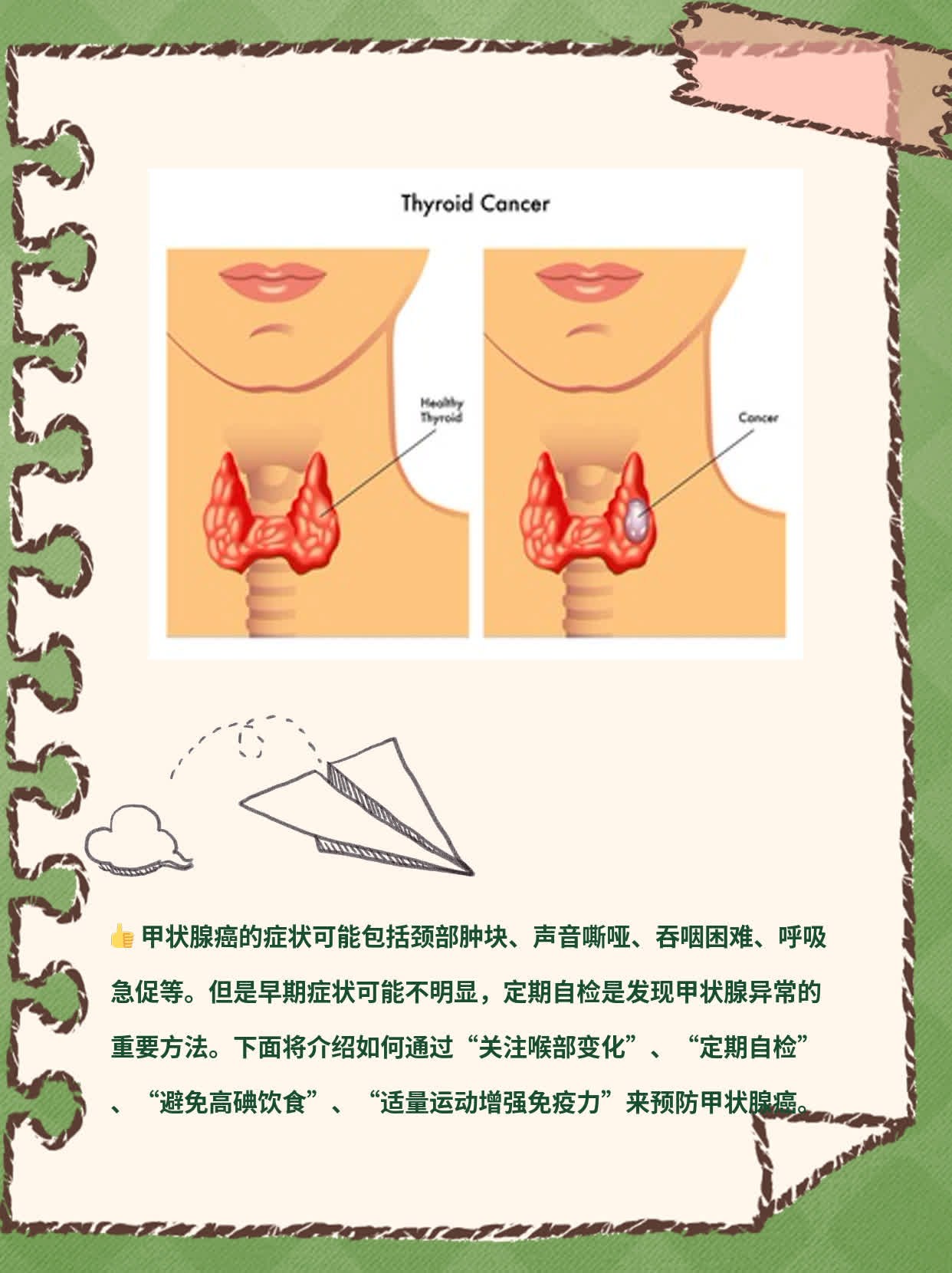 了解甲状腺癌的症状：经验分享