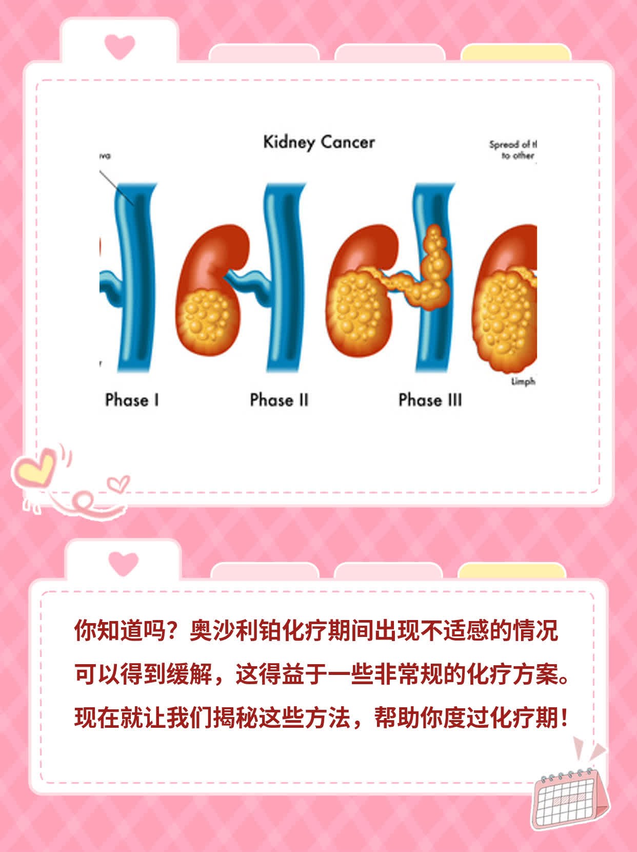 奥沙利铂无不适感？揭秘非常规化疗方案！