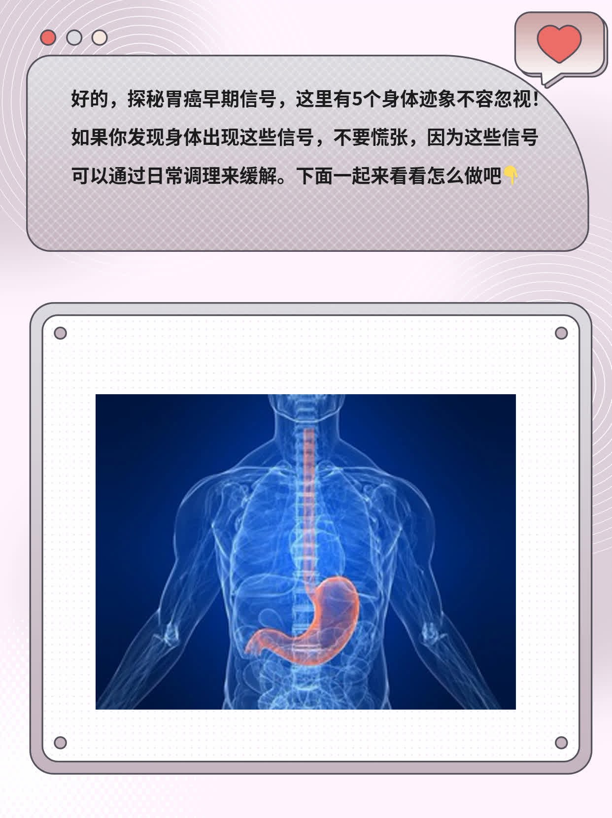 探秘胃癌早期信号：5个身体迹象不容忽视！