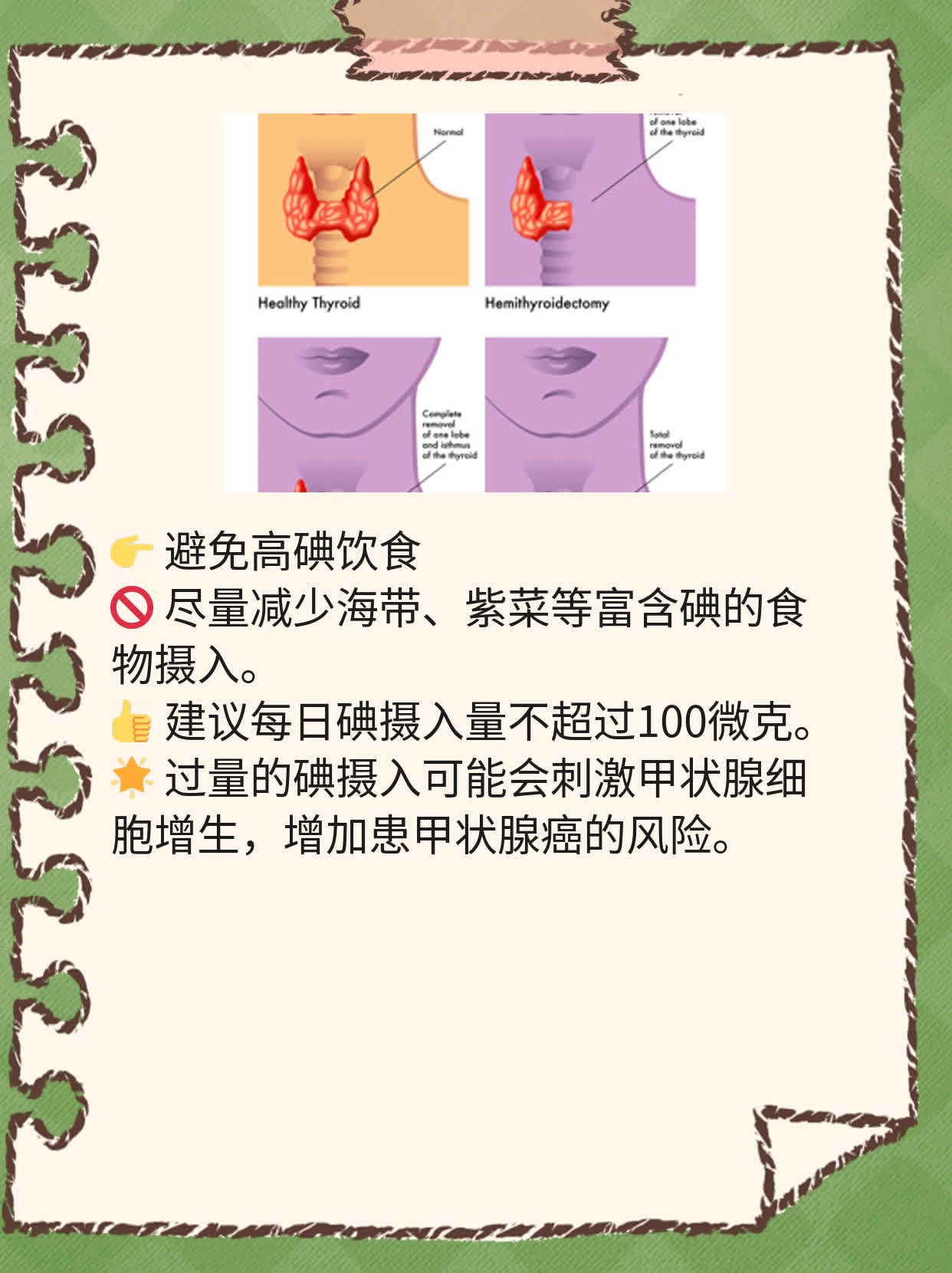 了解甲状腺癌的症状：经验分享