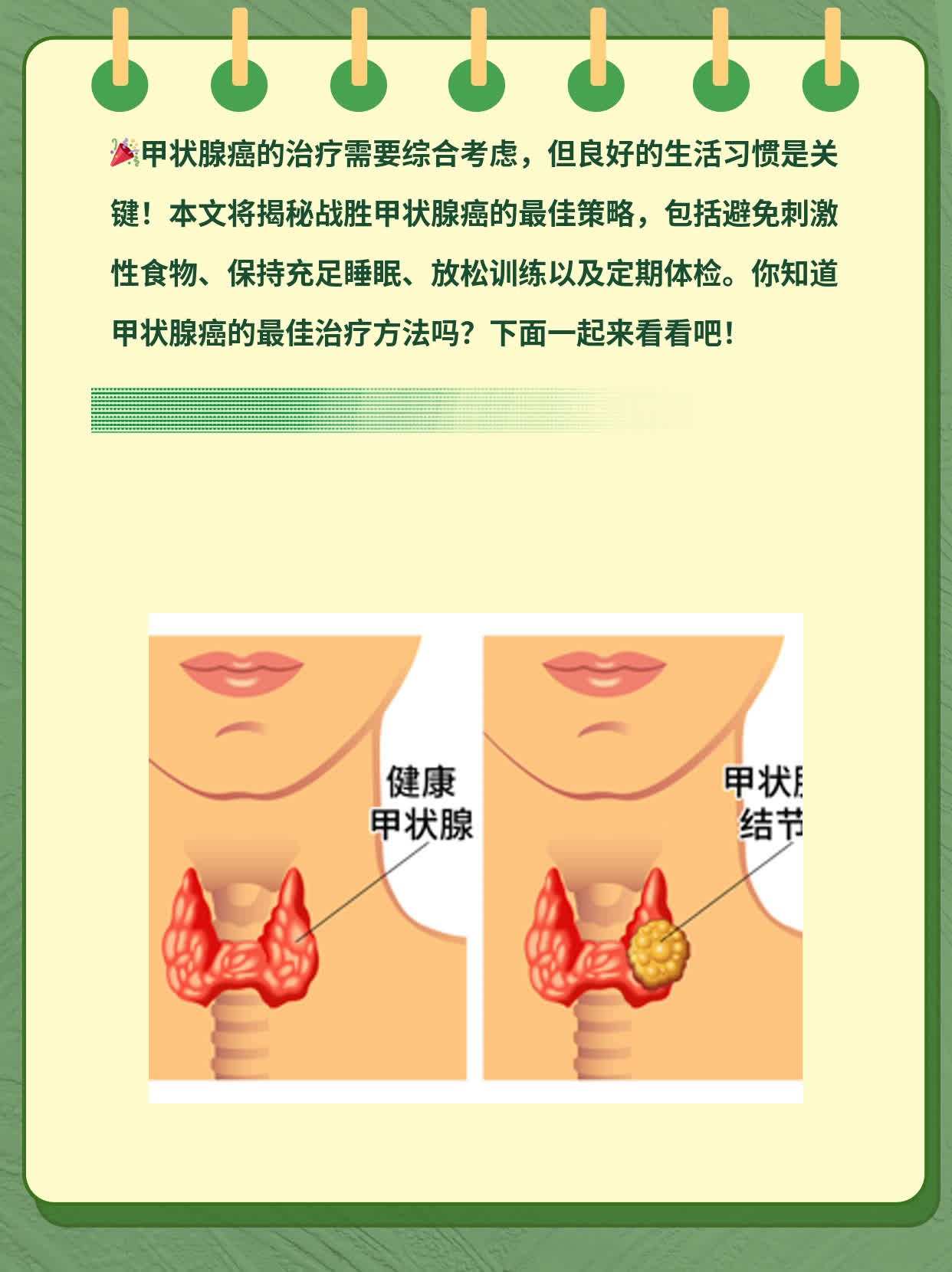 揭秘：战胜甲状腺癌的最佳策略