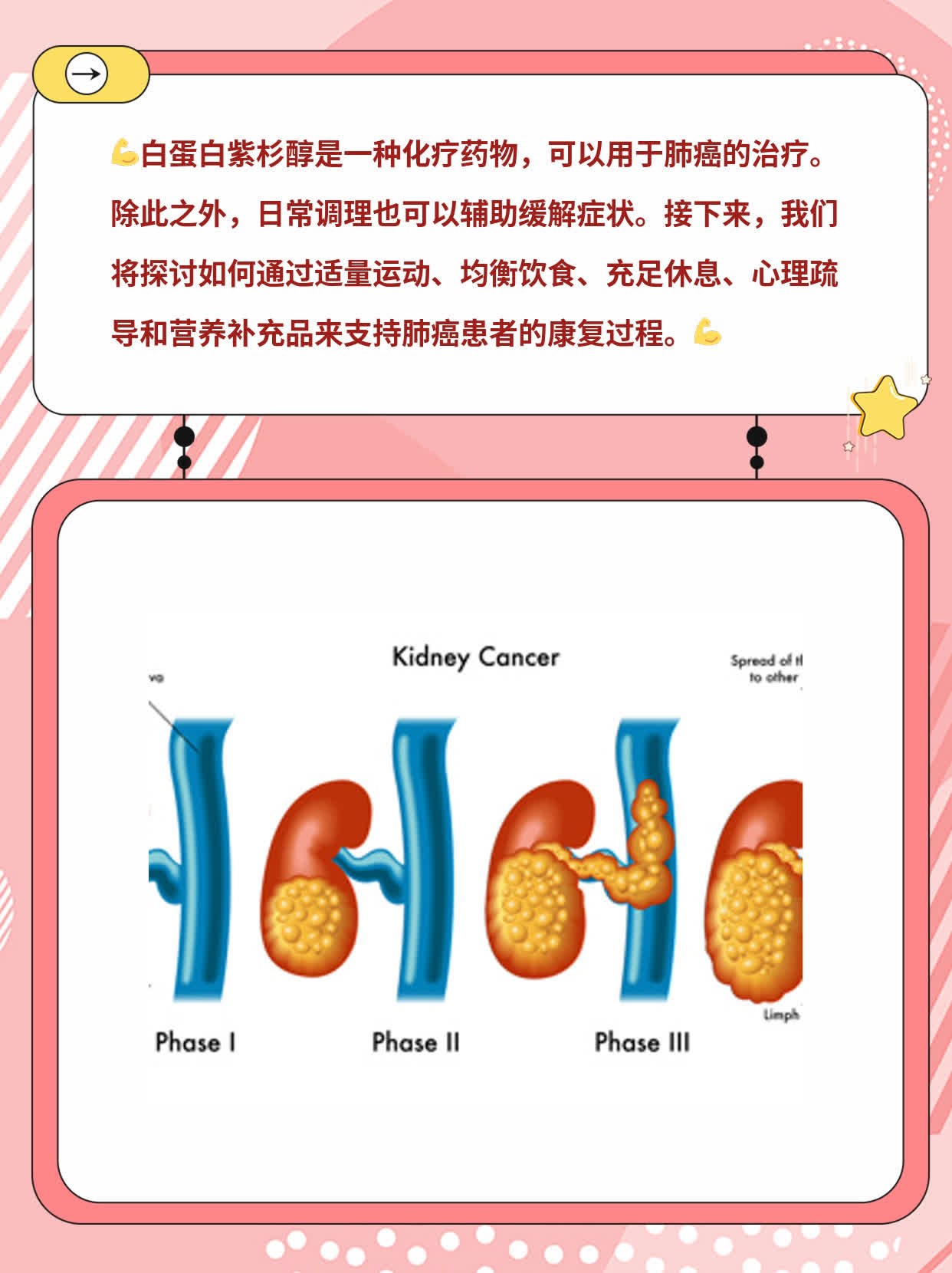 「白蛋白紫杉醇」能治肺癌吗？经验分享！