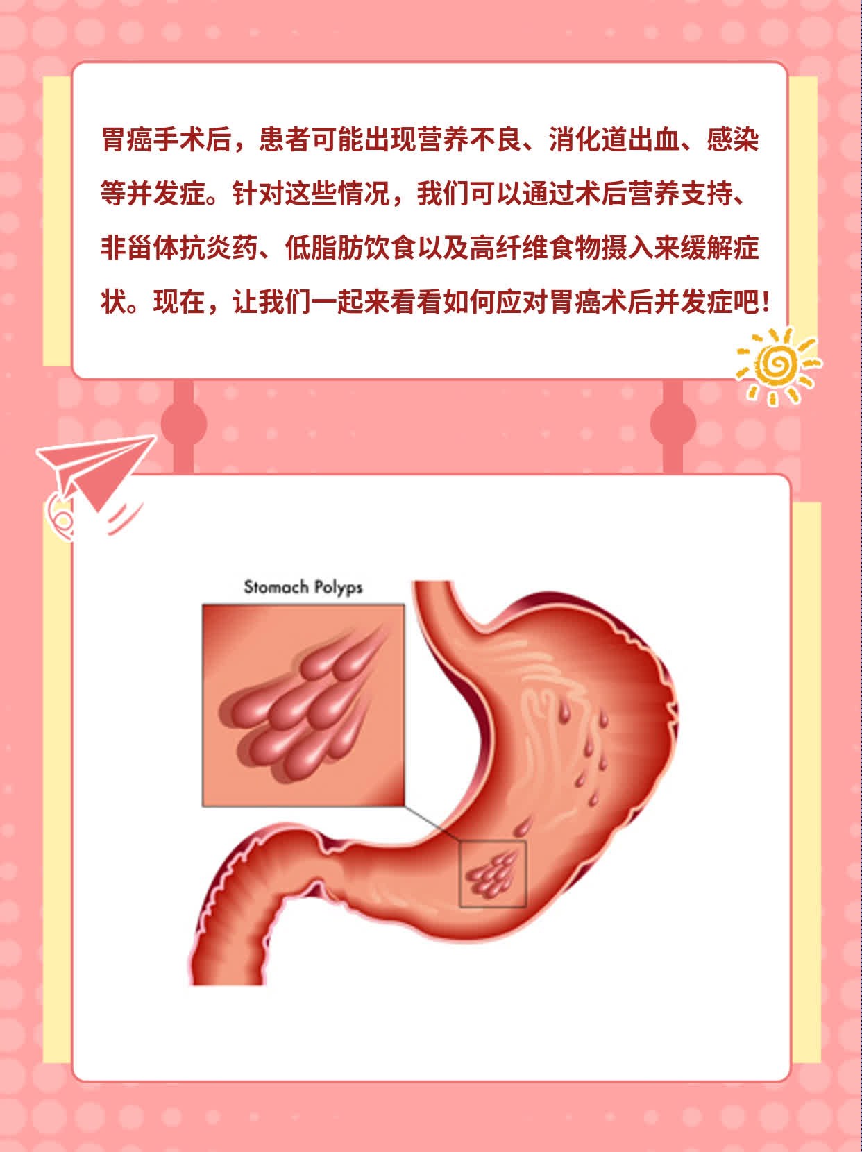 胃癌术后并发症全揭秘！经验分享不容错过！