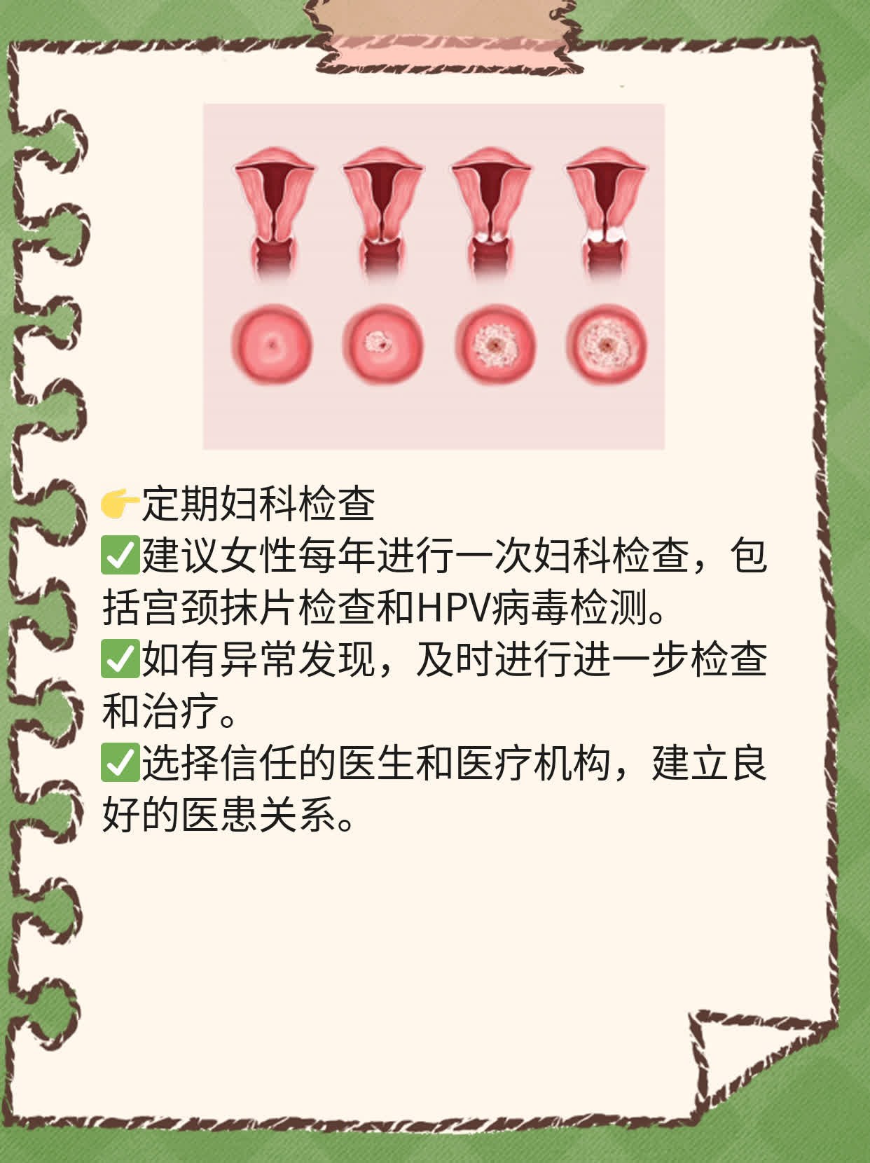 「宫颈癌疫苗」最佳接种年龄是多少？