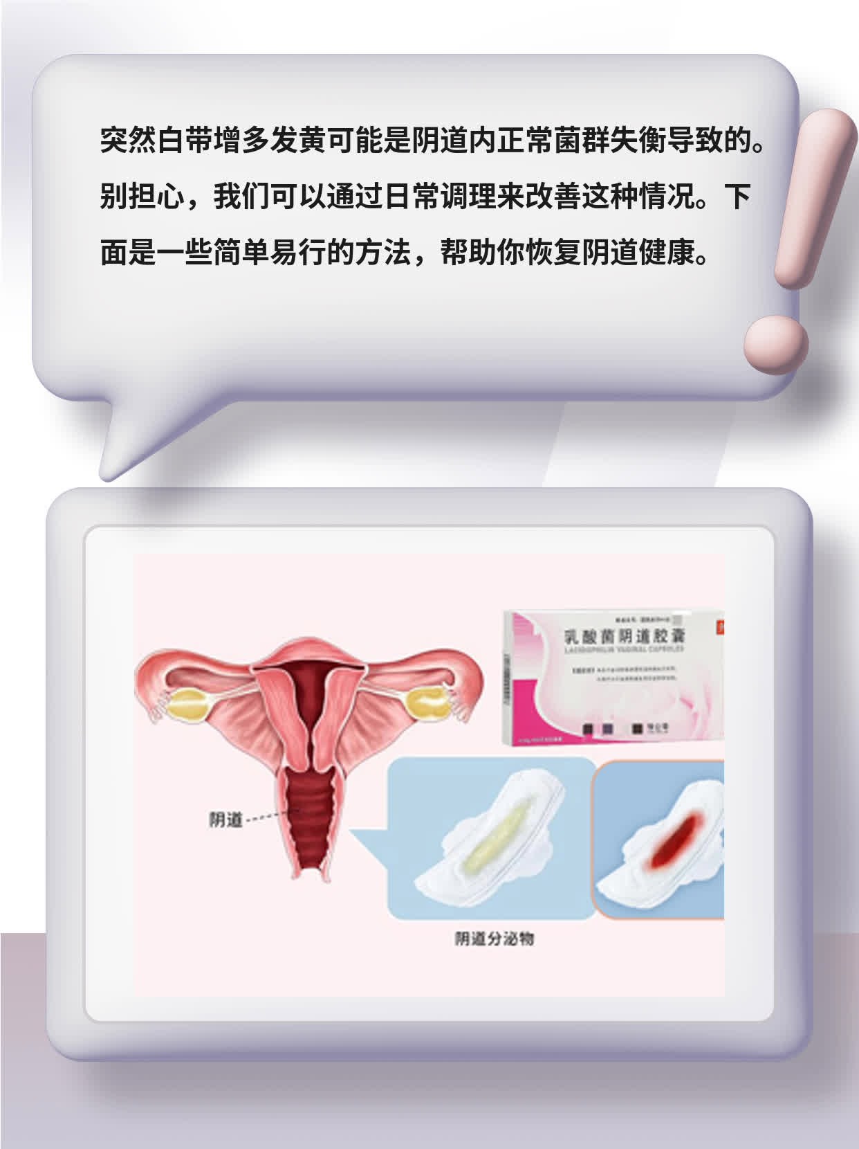 「白带异常」：阴道分泌物颜色、量变化的原因及处理方法