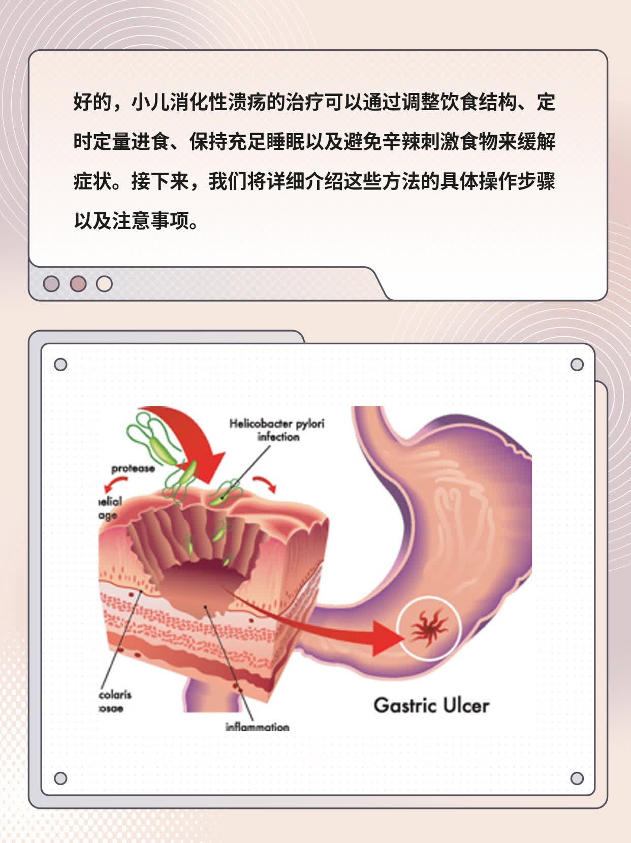 「分享」小儿消化性溃疡的治疗方法大全！